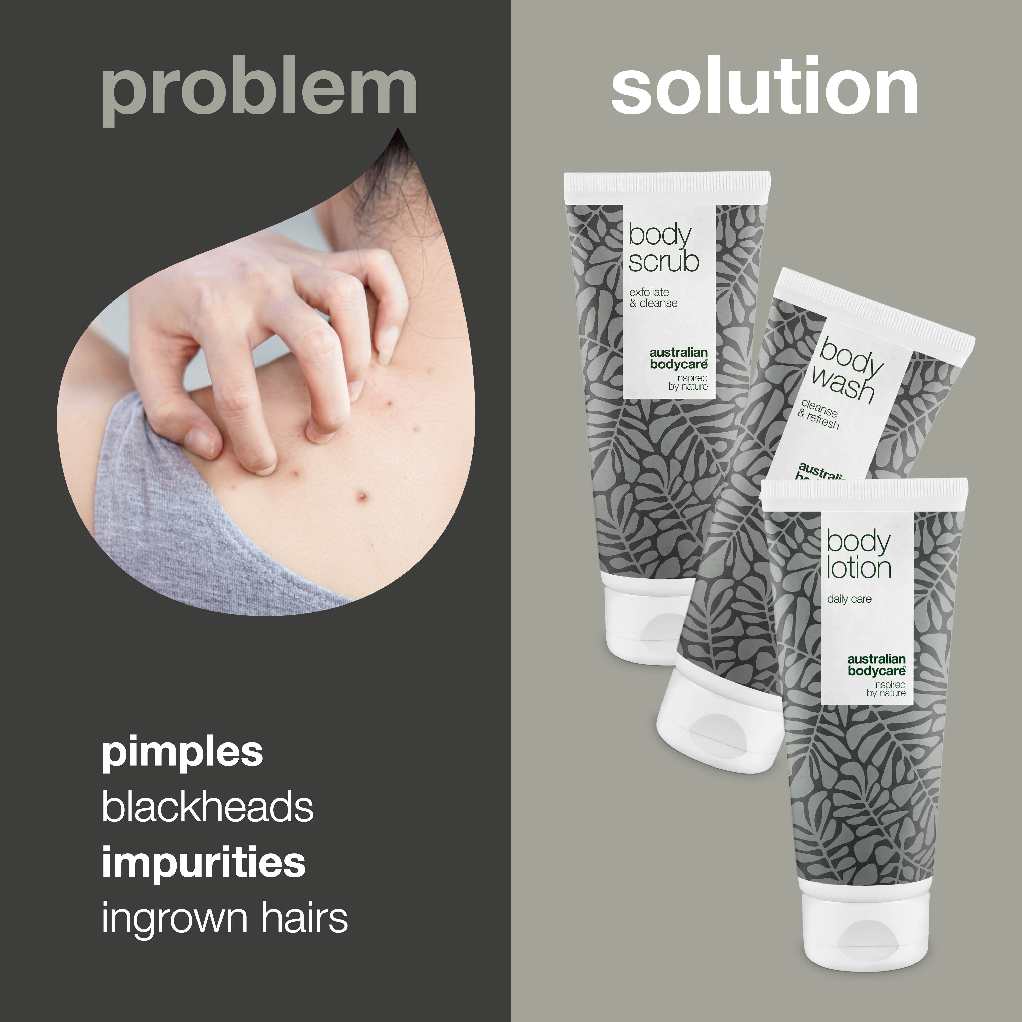 Kit for spots on bum, acne and blackheads on back and bottom — 3 products with natural Tea Tree Oil