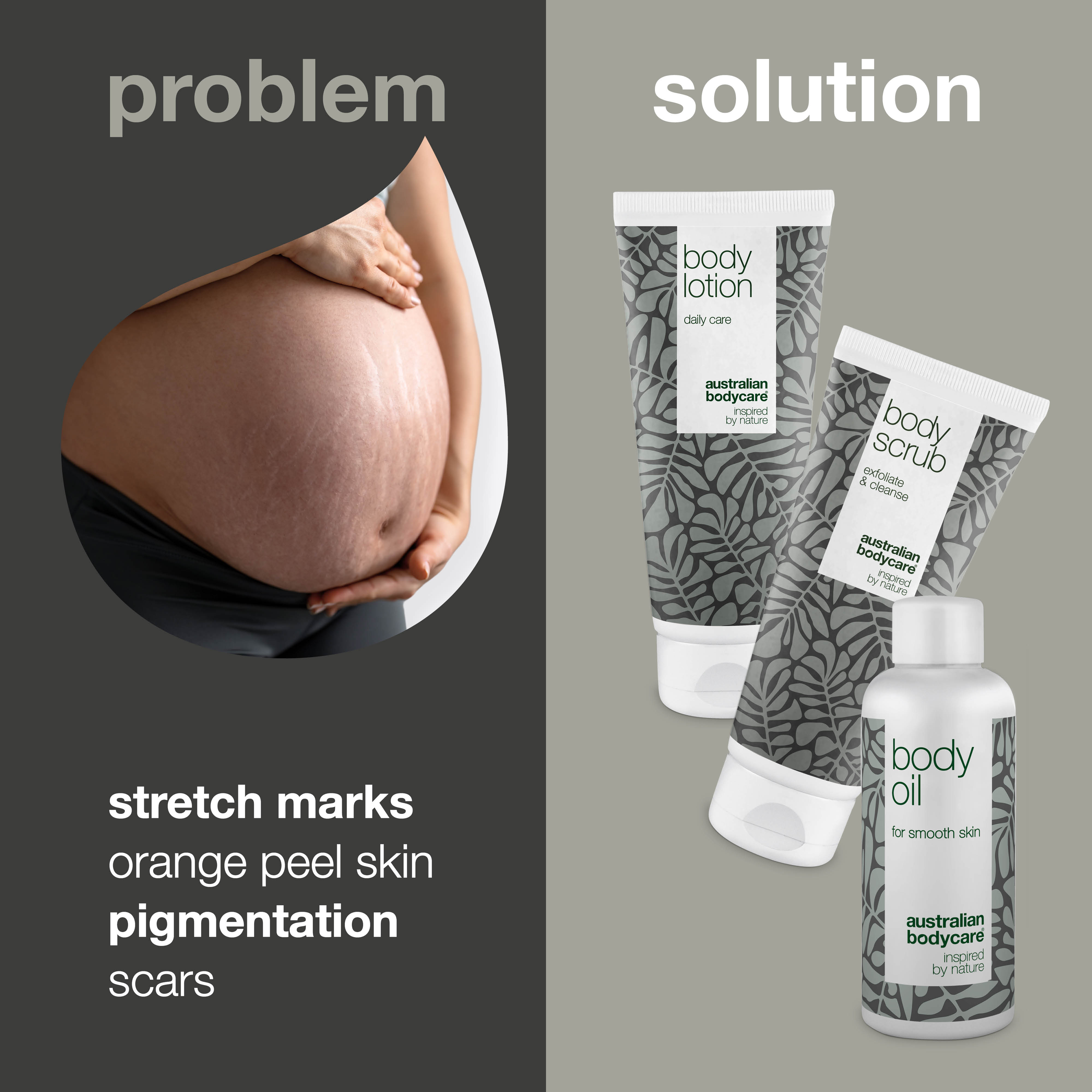 3–Pack to reduce stretch marks — 3 products to reduce the visibility of stretch marks and scars