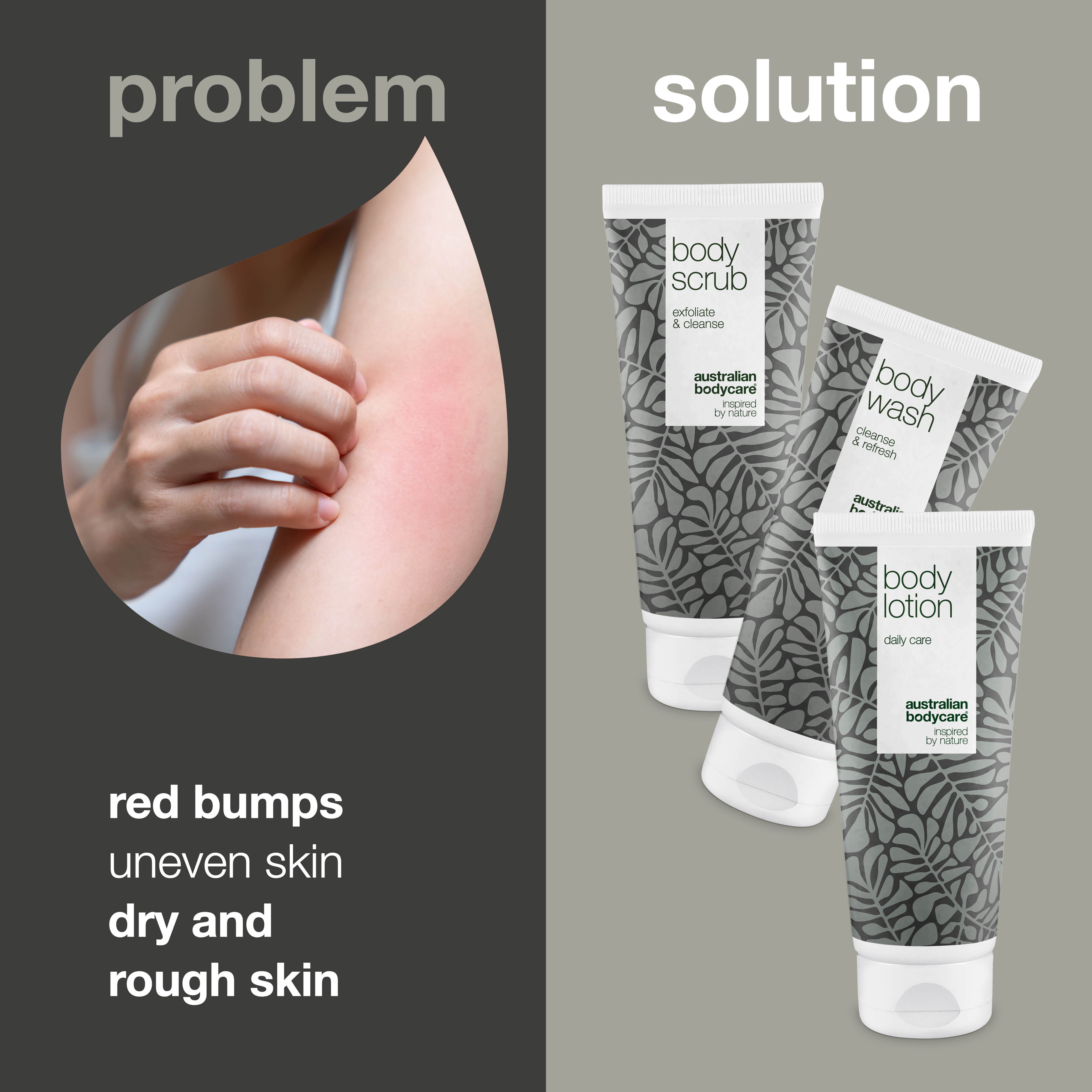 3–pack to care for keratosis pilaris — Minimize small bumps on skin and red spots caused by keratosis pilaris