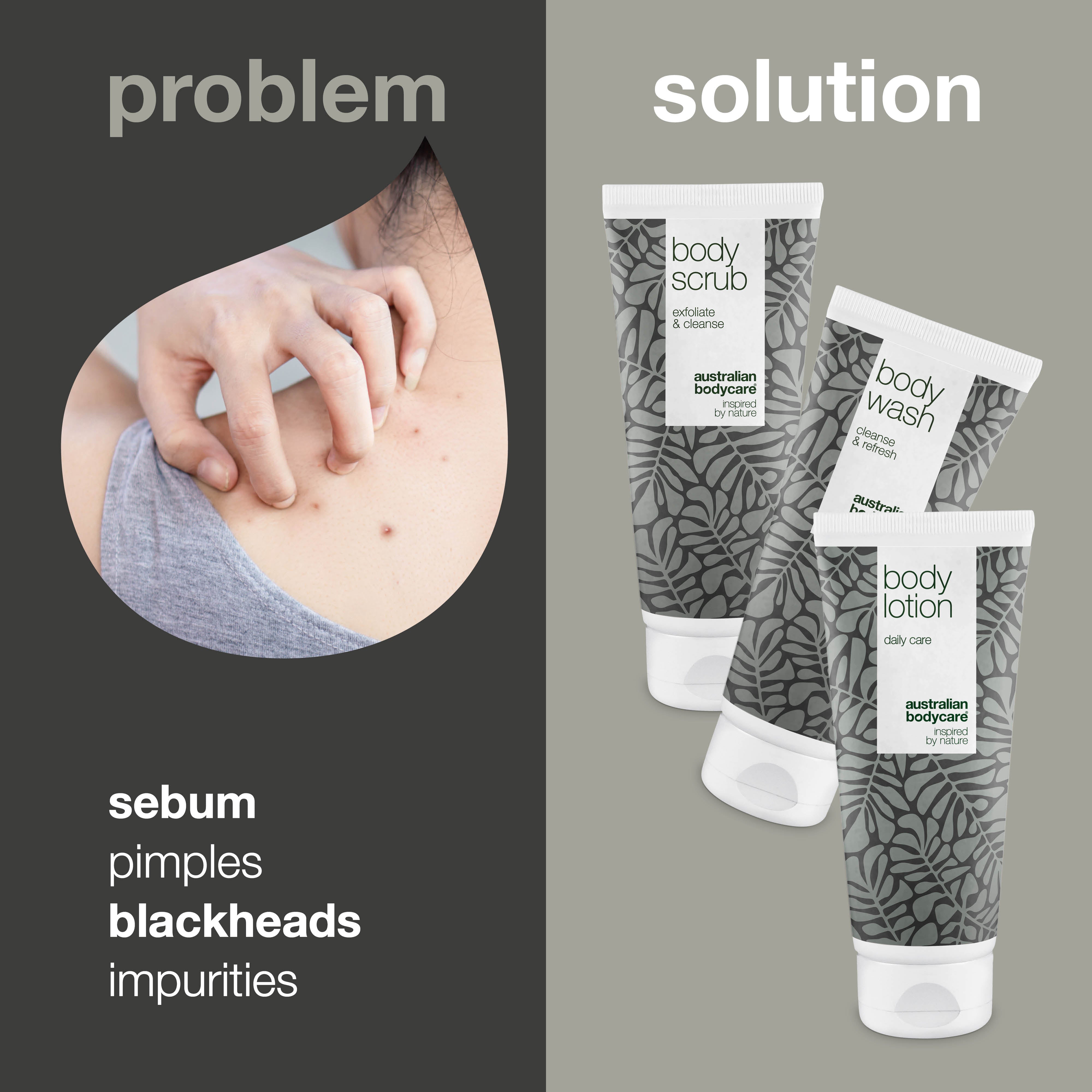 3 products for sebum plugs and whiteheads — The kit cleanses, exfoliates, and moisturizes the skin