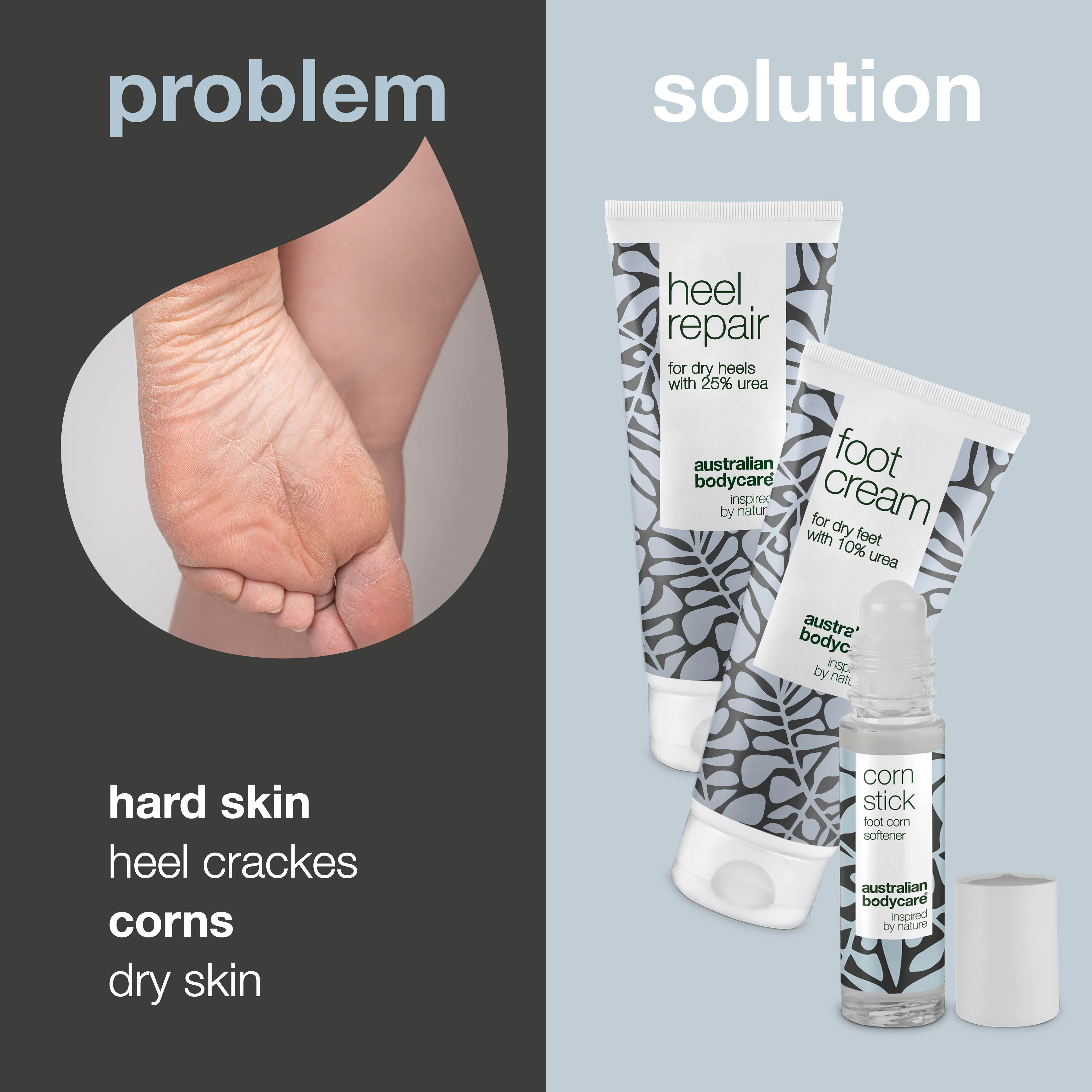 3 Products for calluses and corn on foot — Foot cream, heel cream and corn oil for dry feet.