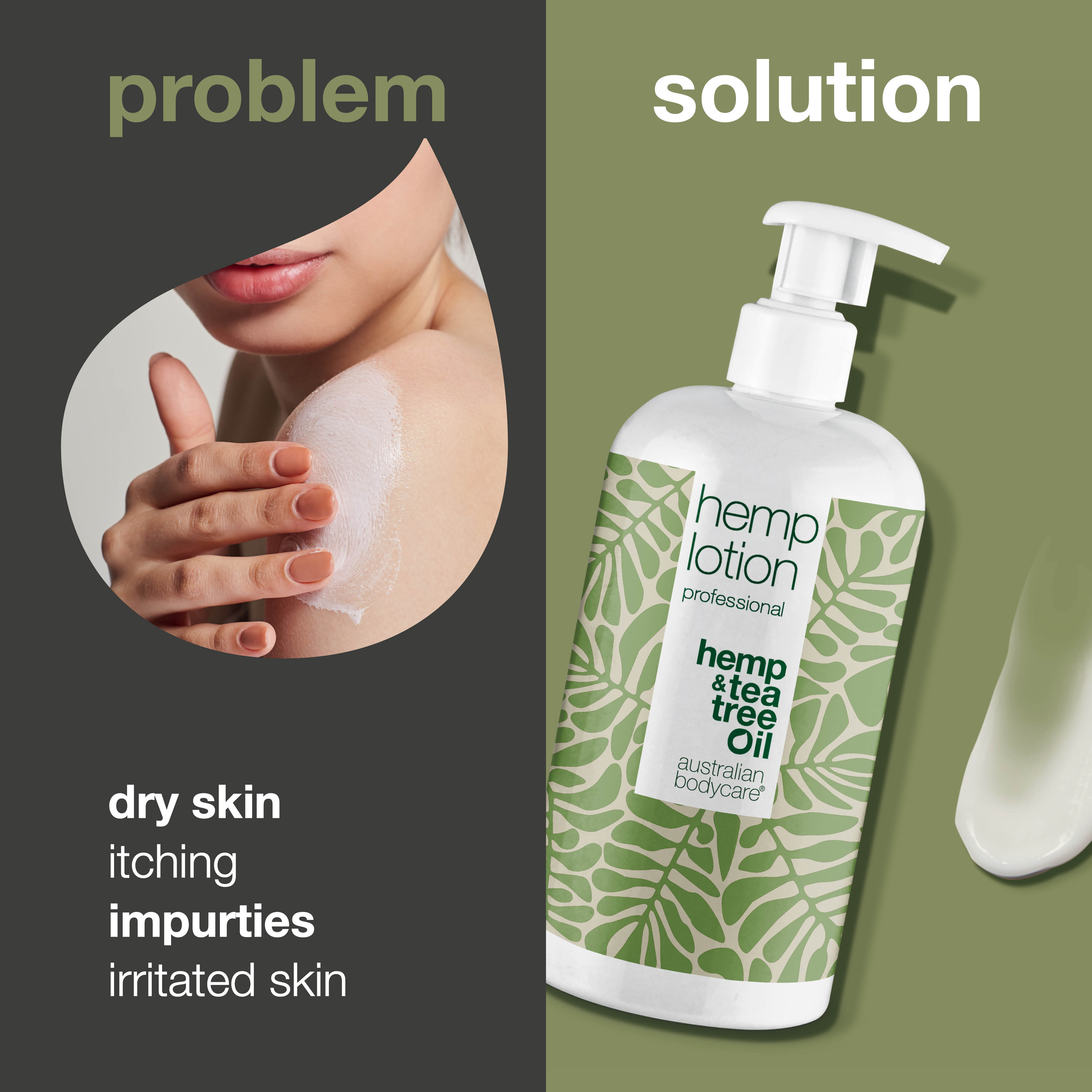 Hemp Body Lotion — Moisturizing care for dry skin and pimples on the body