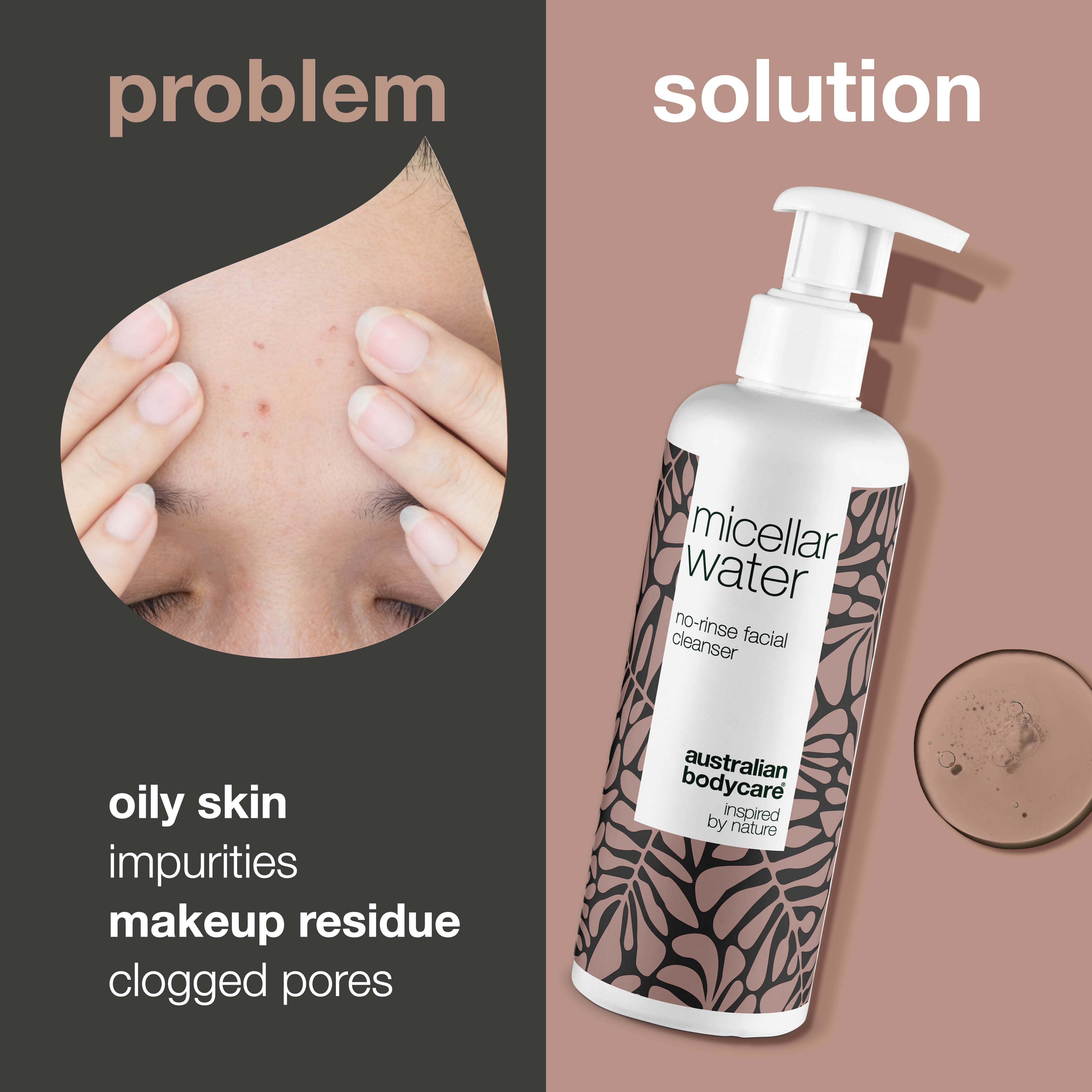 Micellar Water – Effective Cleanser for Oily and Blemish-Prone Skin — Micellar Water removes makeup, dirt, and excess oil. Ideal for daily cleansing and maintaining clear, refreshed skin.