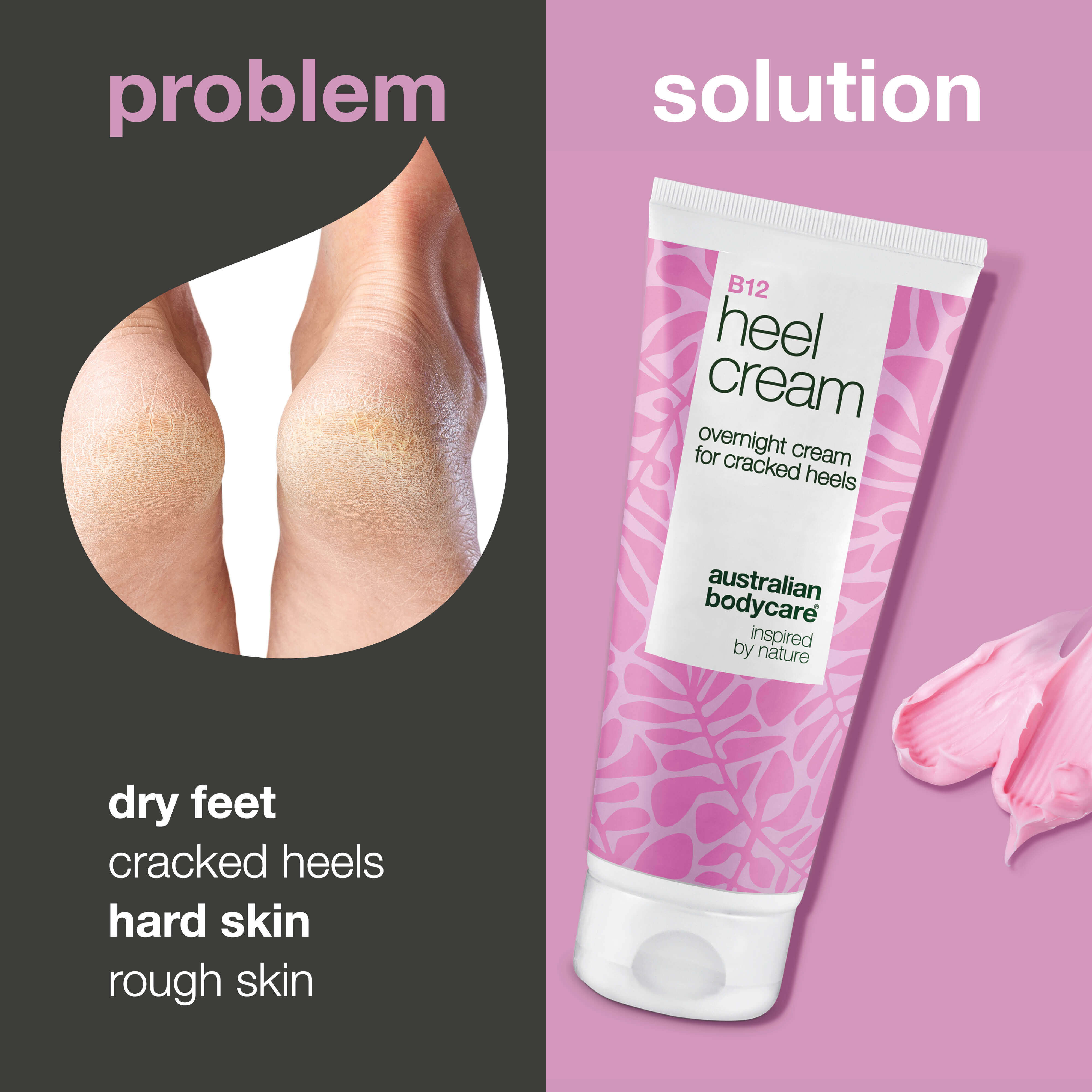 Intensive Heel Care with 25% Urea & Vitamin B12 — Get smooth, healthy feet with this heel cream. Hydrates and restores dry skin with 25% urea & Vitamin B12.