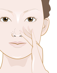 How to get rid of blackheads