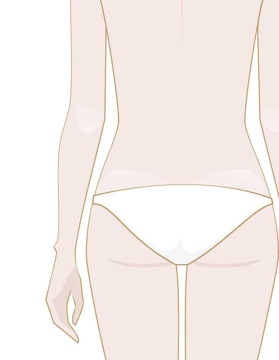 Do you have stretch marks on your buttocks?