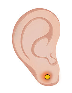 How to deal with an infected ear piercing