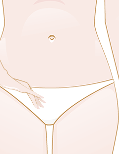 Pimples on labia – Read about reasons and treatment