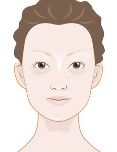 Dark circles under your eyes