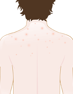 spots on the neck