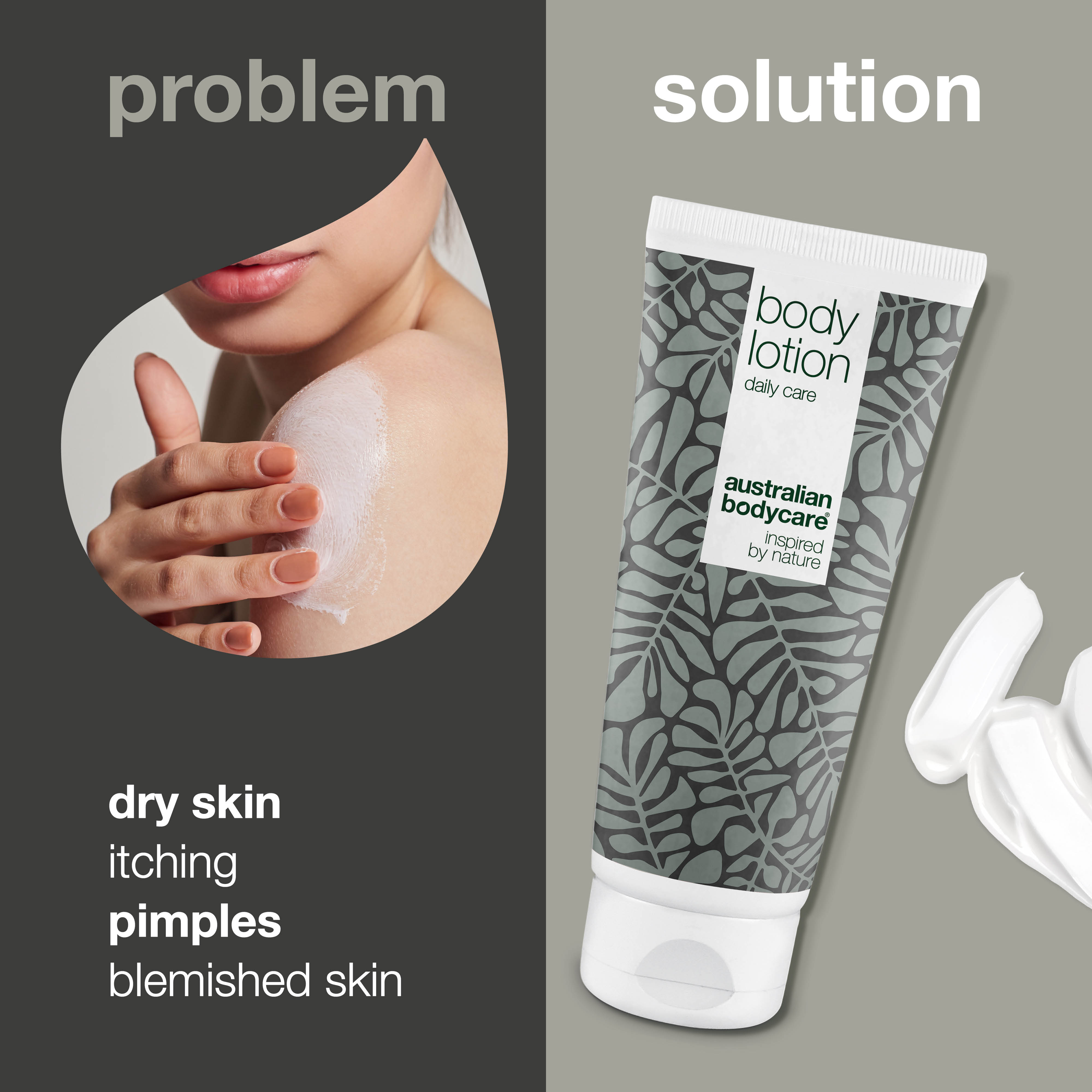 Tea Tree Body Lotion against dry skin and spots — Body moisturiser for congested and scaly skin on the body