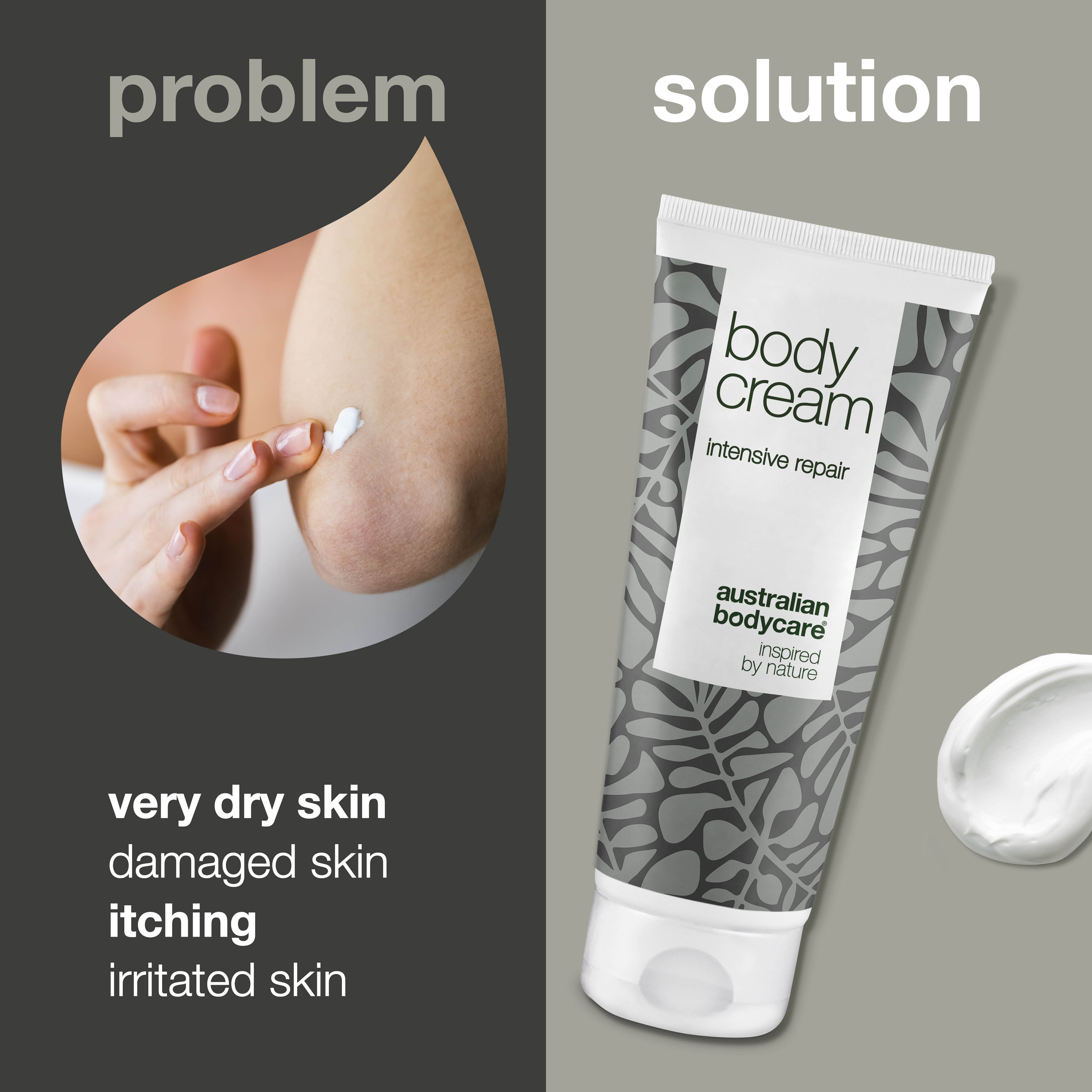 Body Cream for very dry skin and itching — Intensive body moisturiser for damaged, very dry and itchy skin