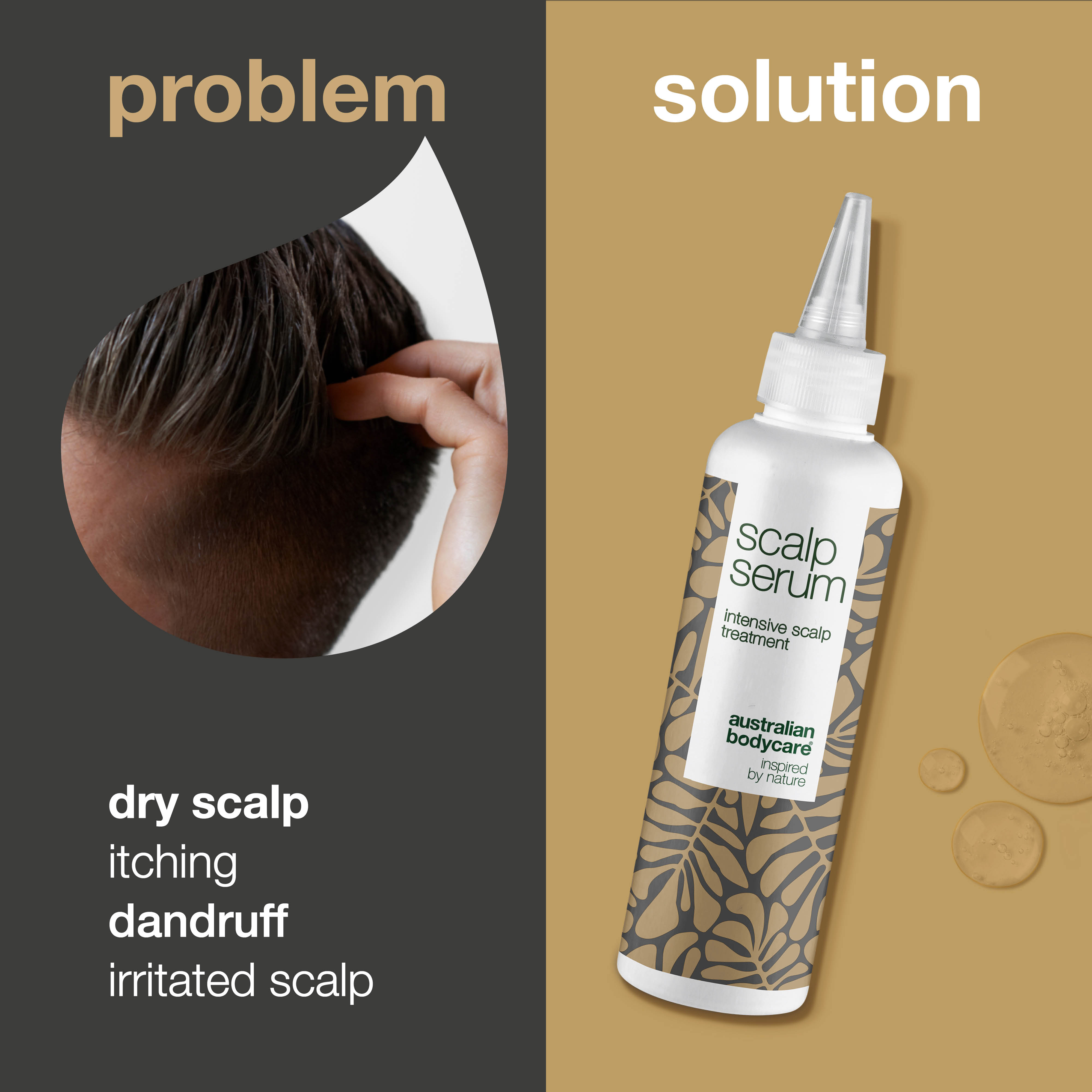 Scalp treatment against dandruff and dry scalp — Scalp serum for itchy scalp, greasy hair, dry and scalp irritation