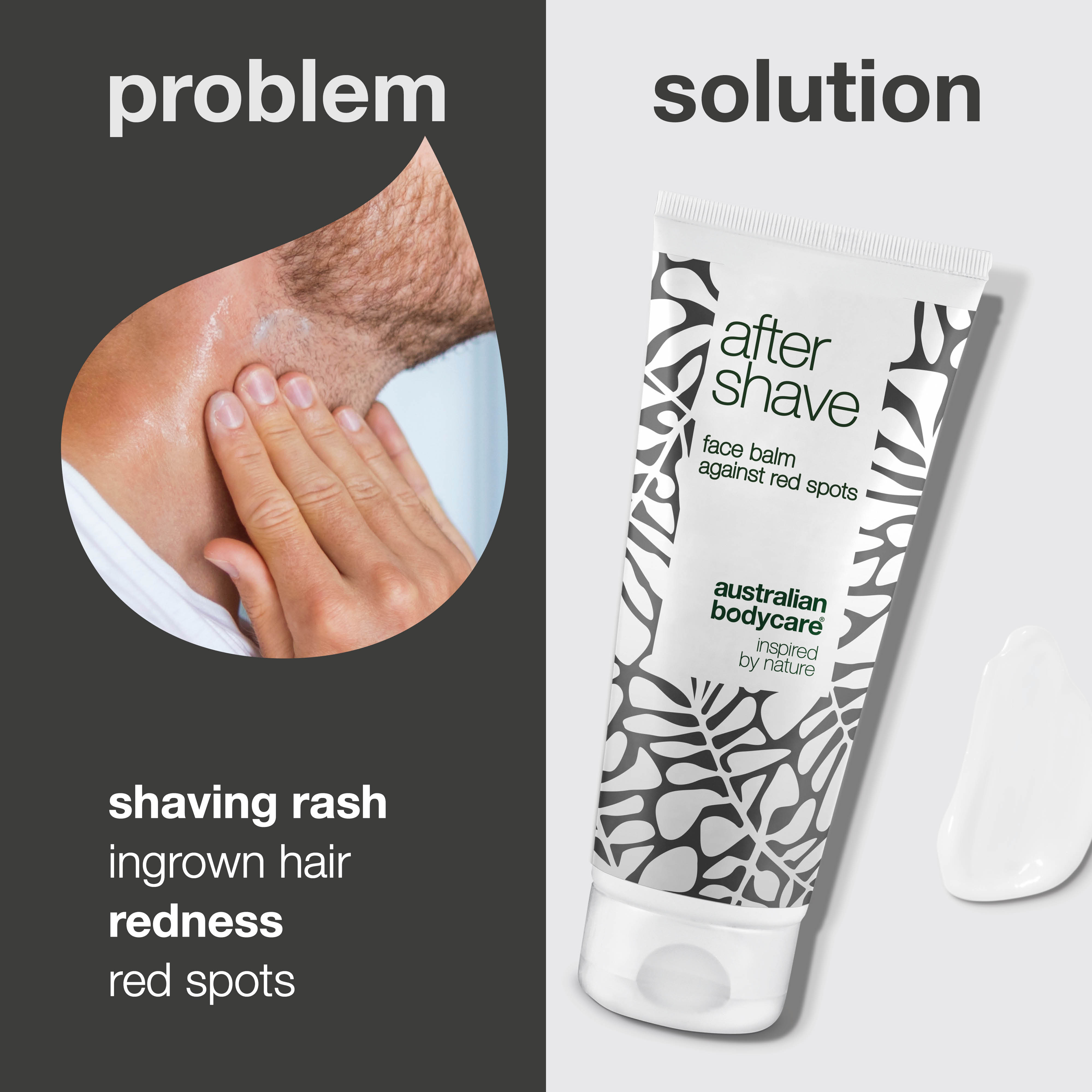 After Shave against razor burn and razor bumps — Aftershave lotion to prevent shaving rash and ingrown hair