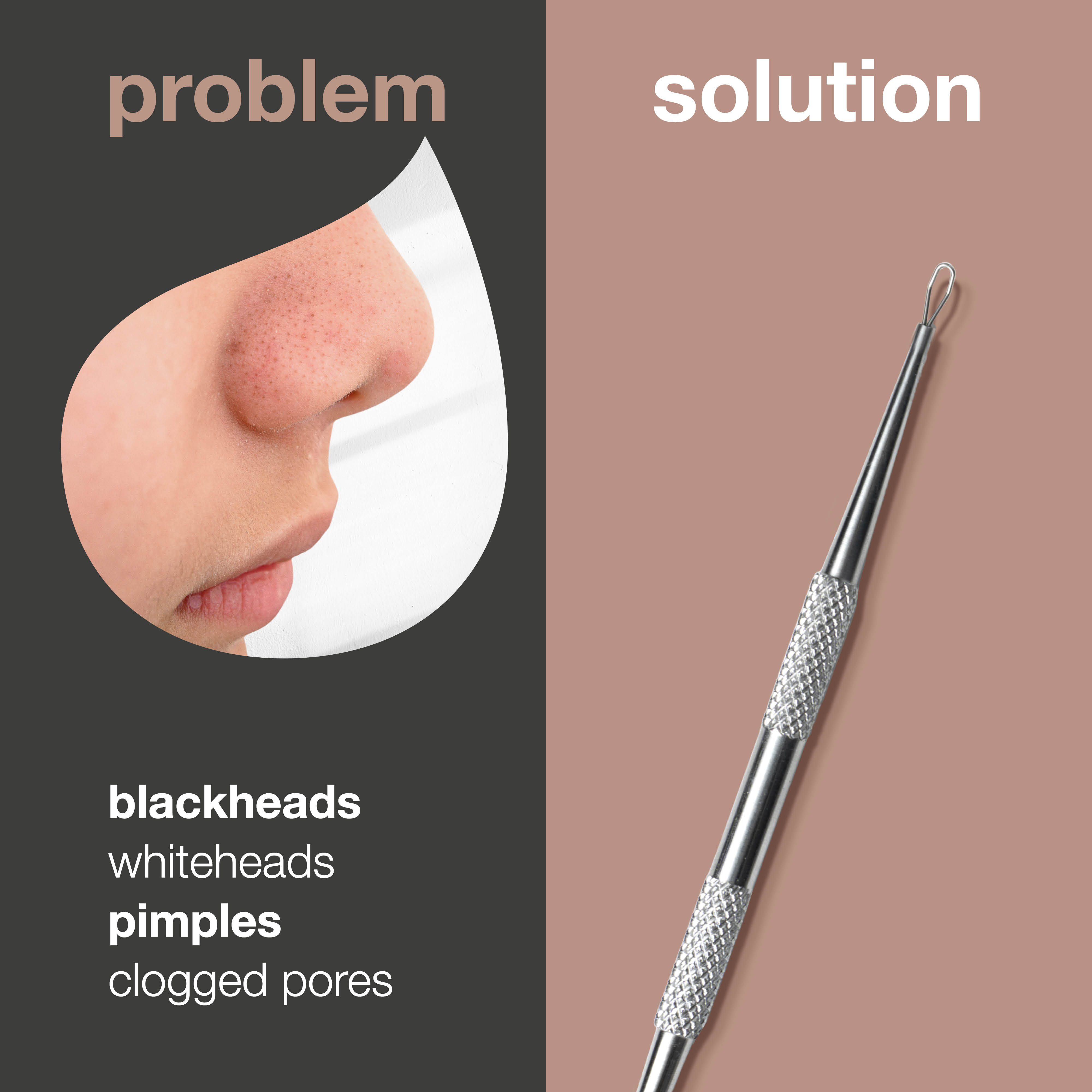 Australian Bodycare Blackhead Remover — Get rid of blackheads