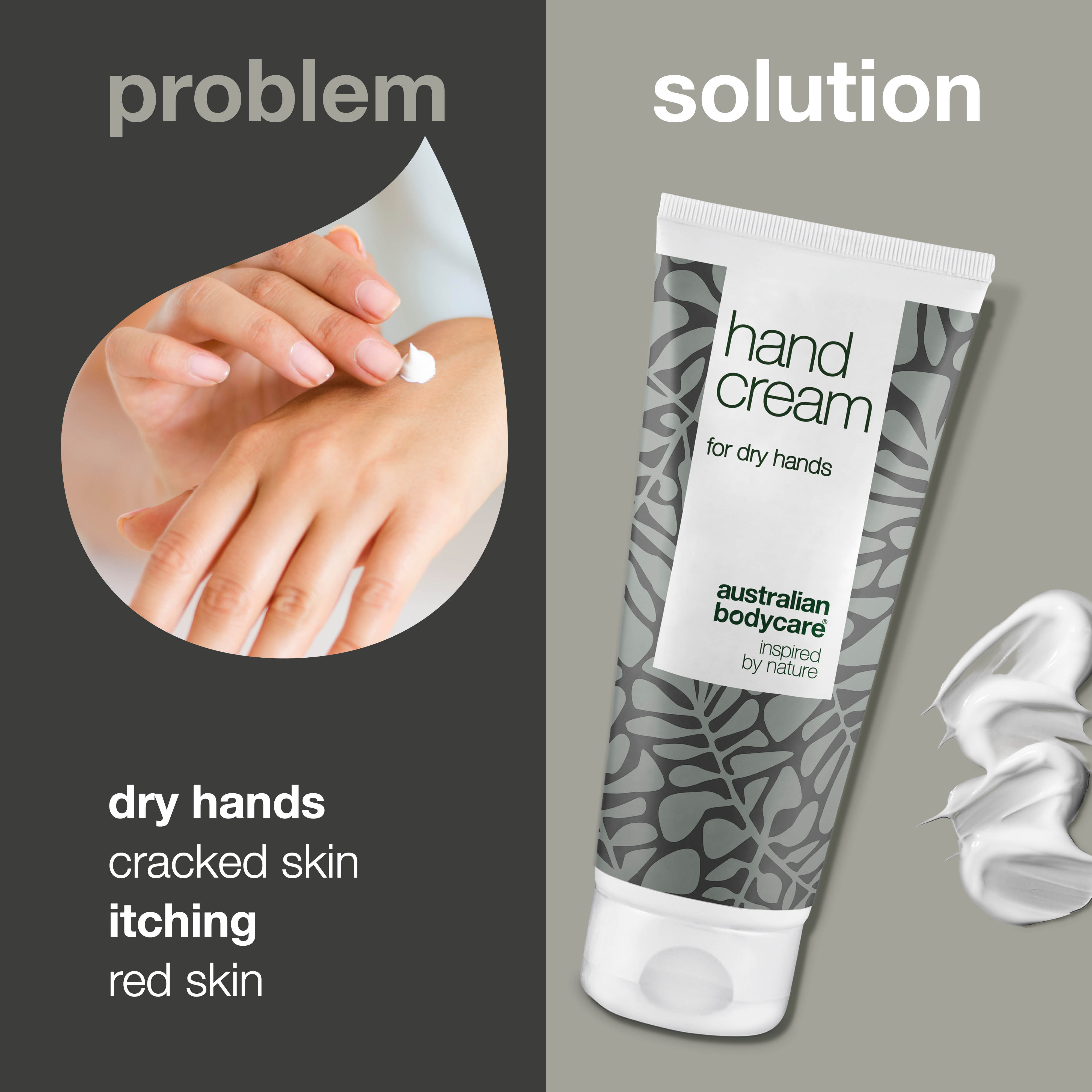 Tea Tree Hand cream for red and dry hands — Hand lotion for the daily care of cracked, itchy hands or with red skin