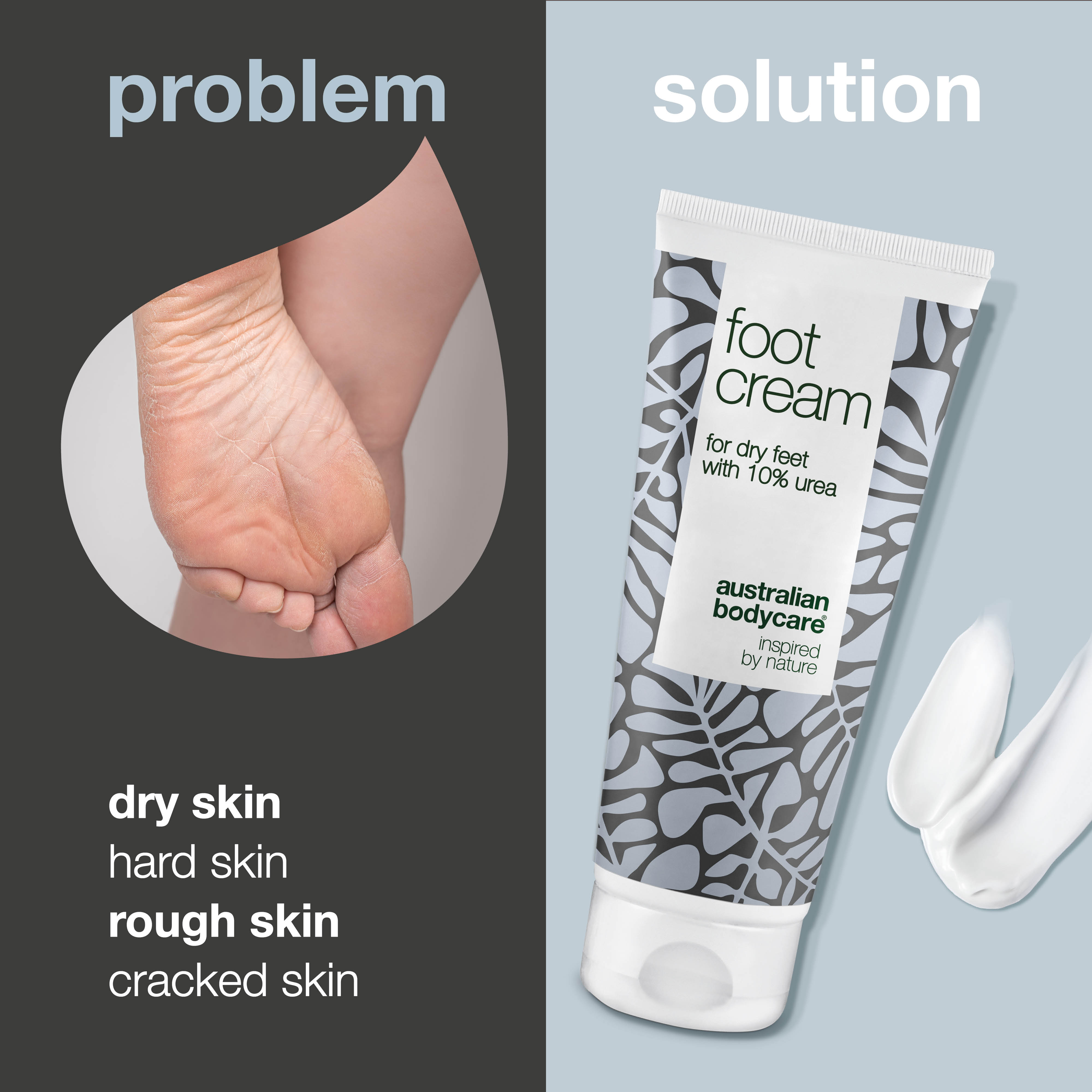 Foot Cream with 10% urea for dry feet — Nurturing foot cream for dry skin on feet with 100% natural Tea Tree Oil