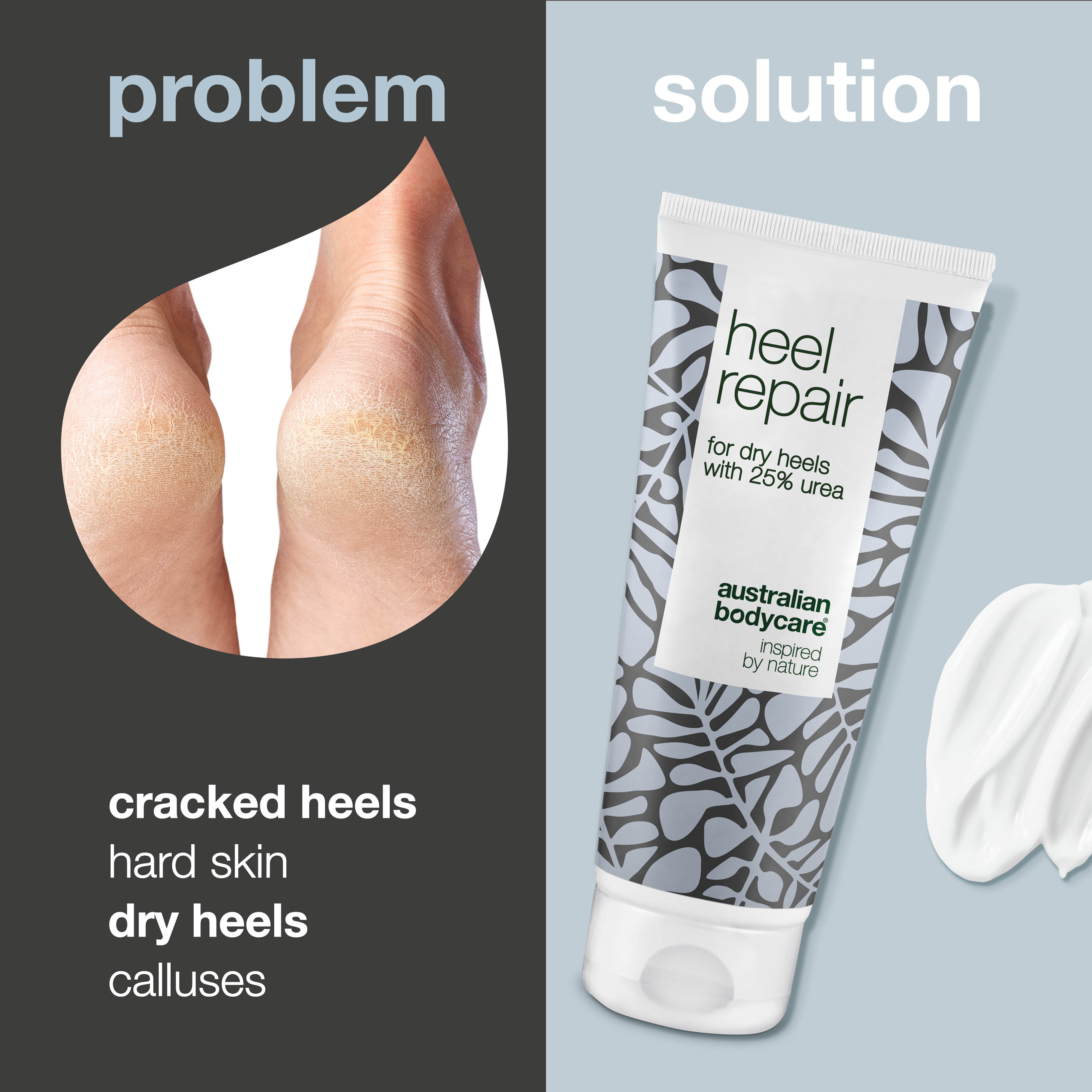 Heel Cream for Dry and Cracked Heels — Tackle cracked heels and dry feet with our heel repair. Contains 25% urea and natural 4-Terpineol, known from Tea Tree Oil.