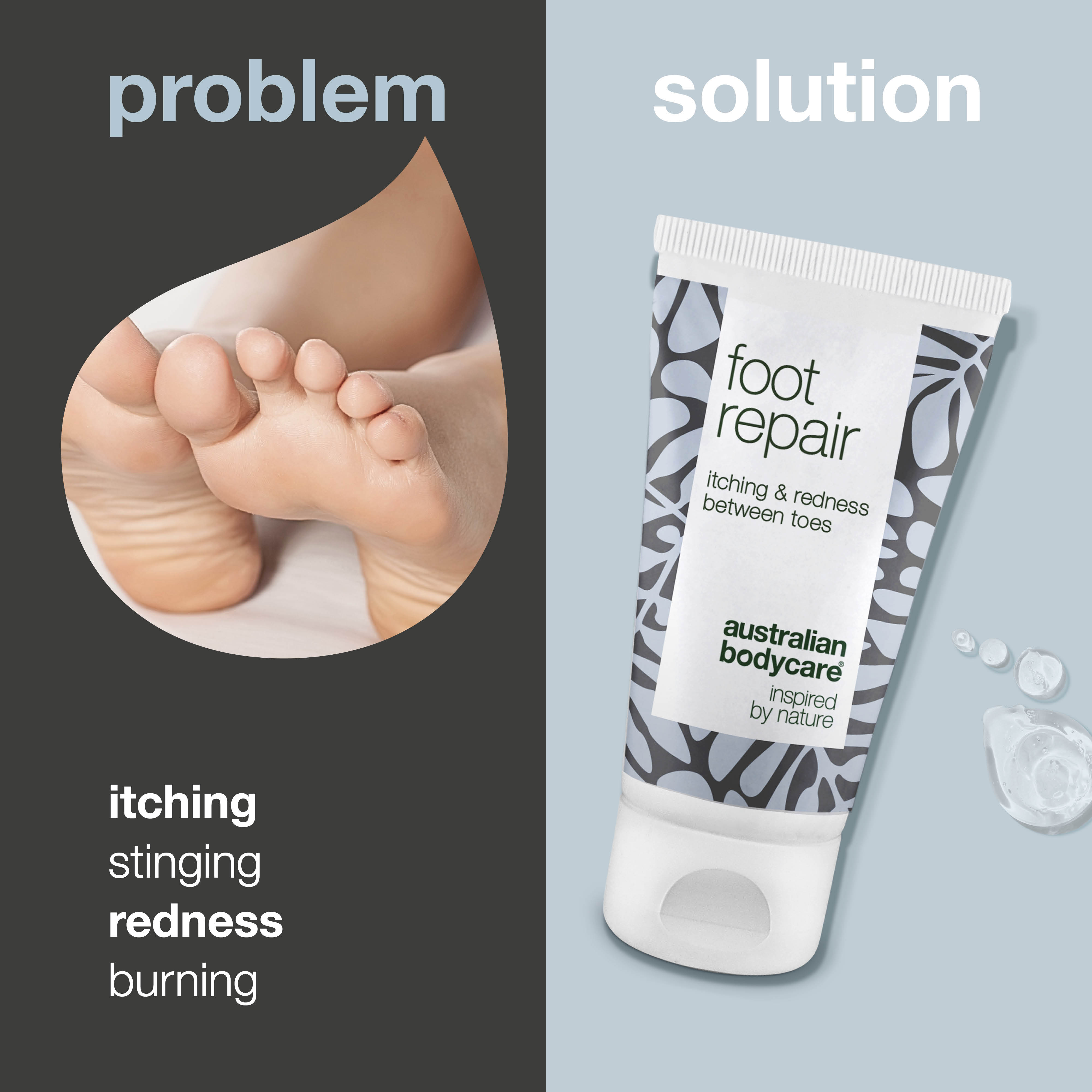 Foot Gel for Red & Itchy Toes  — Get relief from itching, stinging, and redness between your toes with this soothing gel. Contains natural 4-terpineol, known from Tea Tree Oil. Ideal for daily care and relief.