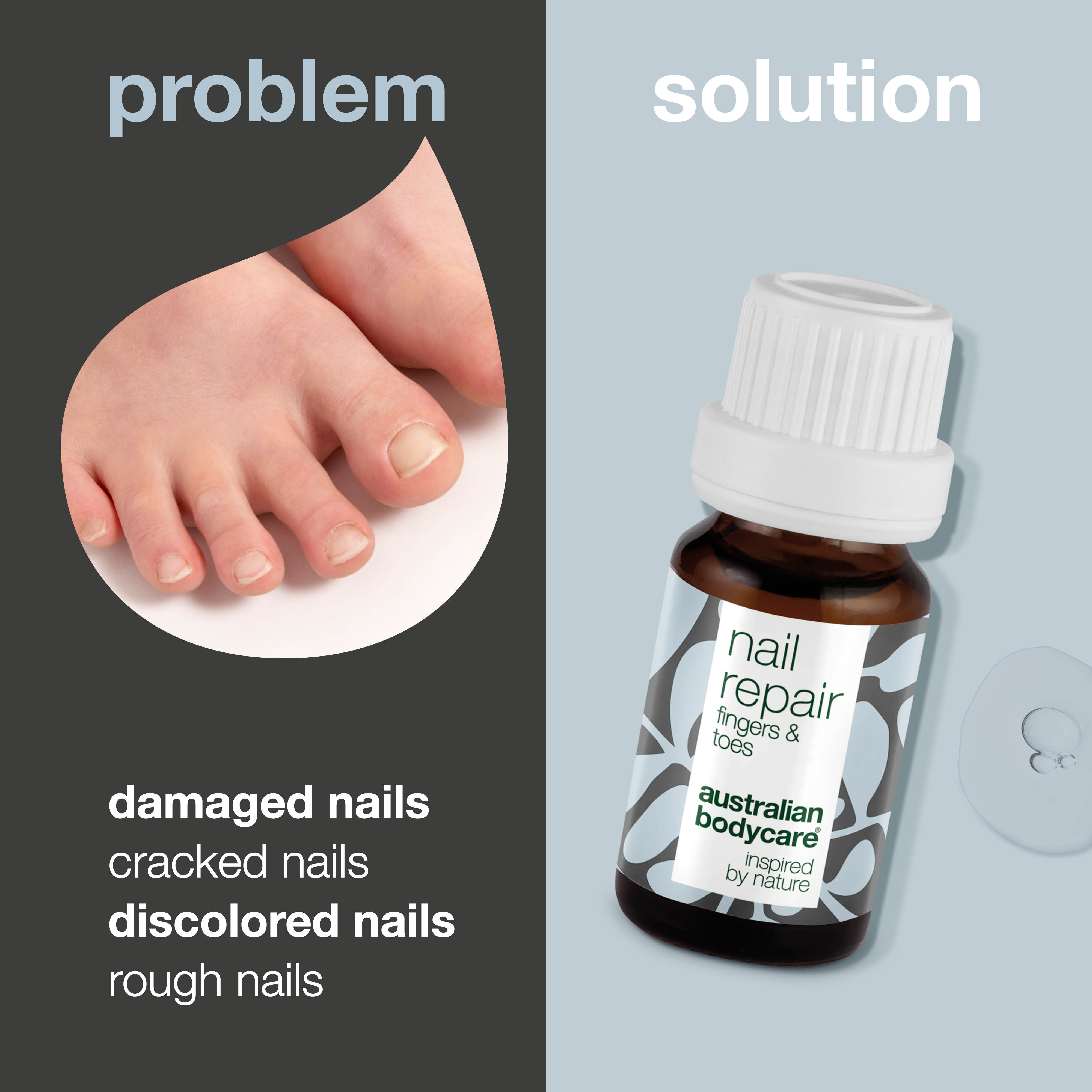 Nail Oil for Cracked and Discoloured Nails — Restore the health of your nails with our nail oil. It combats cracked, rough, and discoloured nails using natural 4-terpineol, known from Tea Tree Oil, and vitamin E.