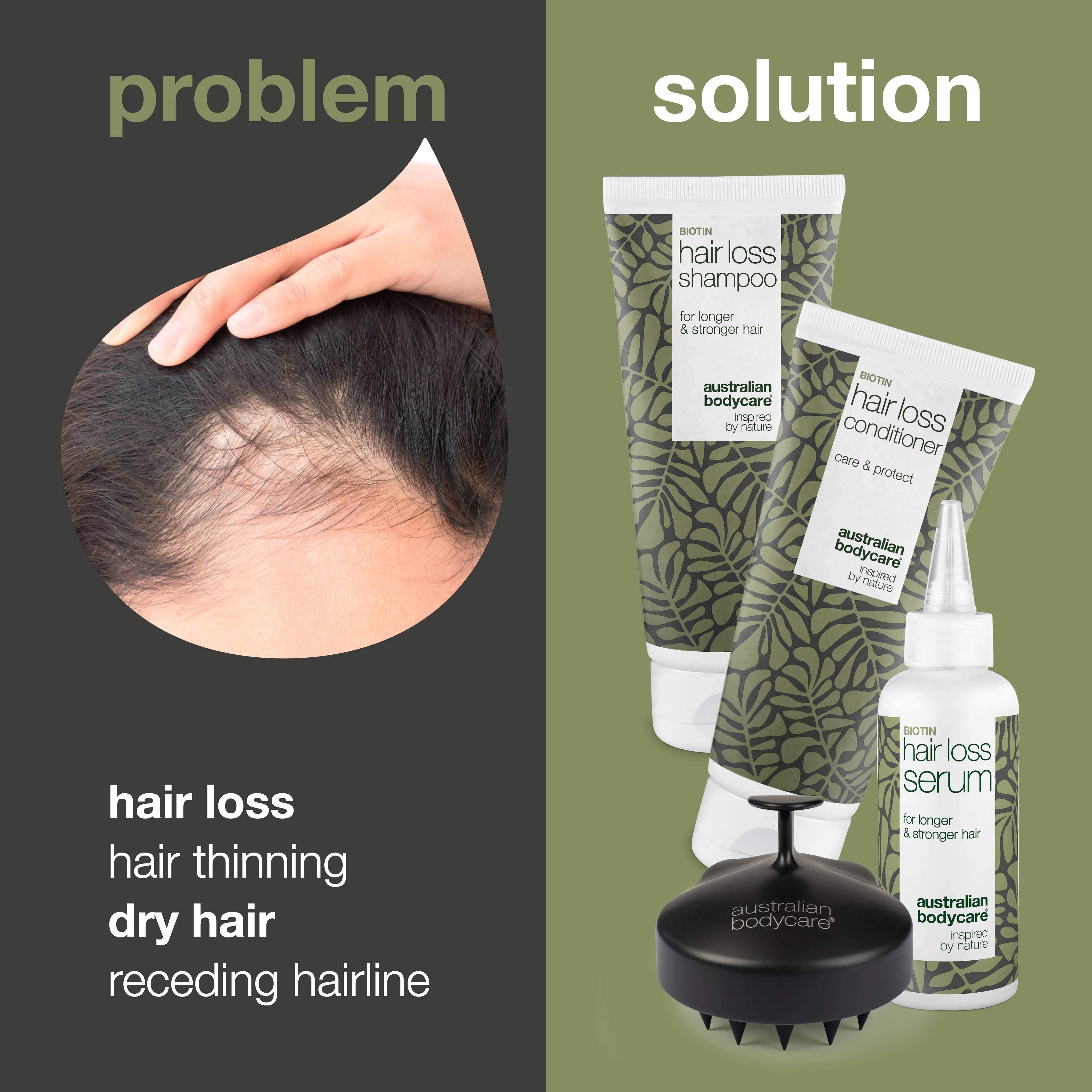 The ultimate hair loss kit — 4 products for hair loss & hair thinning