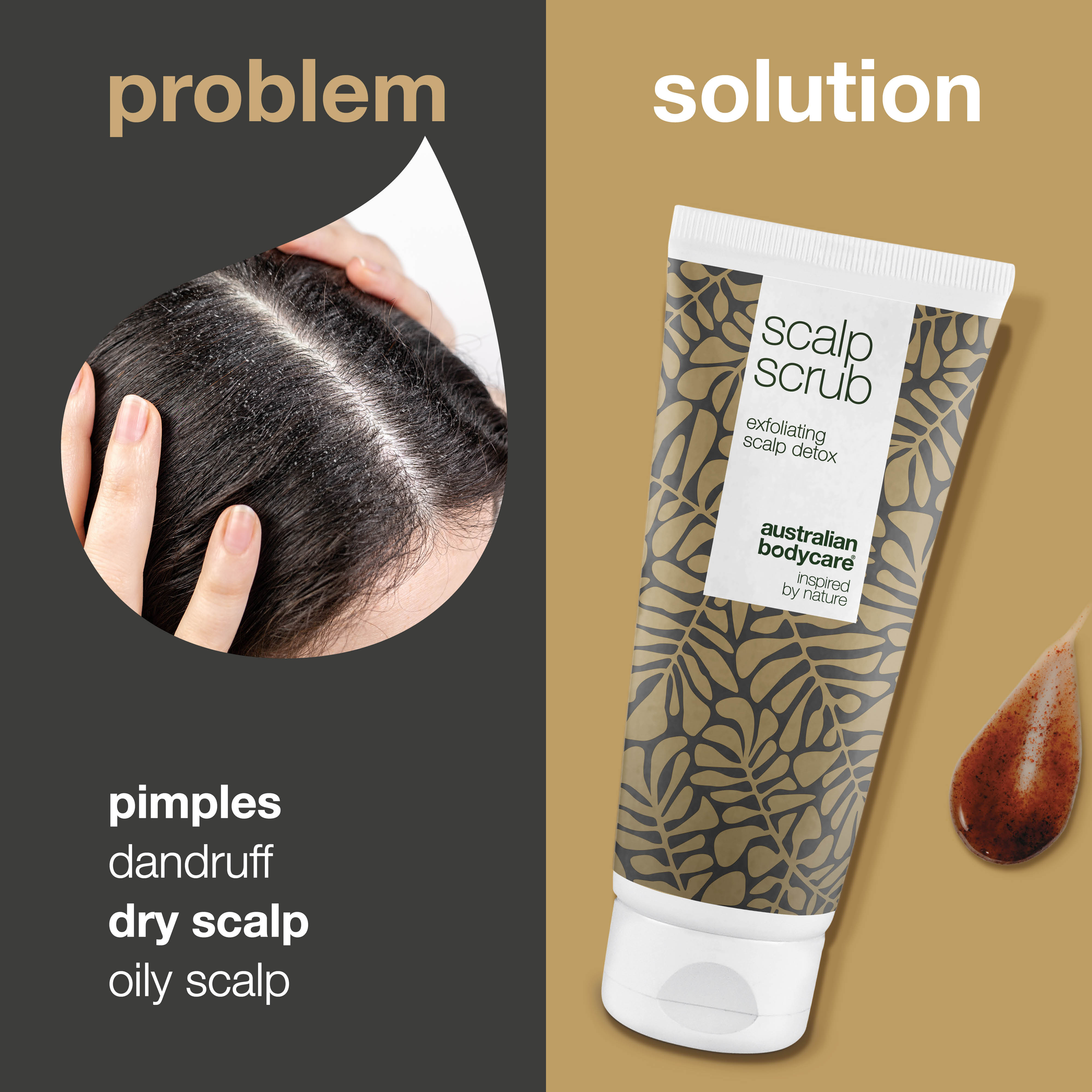 Exfoliating Scalp Scrub — Scalp exfoliator for pimples, dandruff, dry or oily scalp