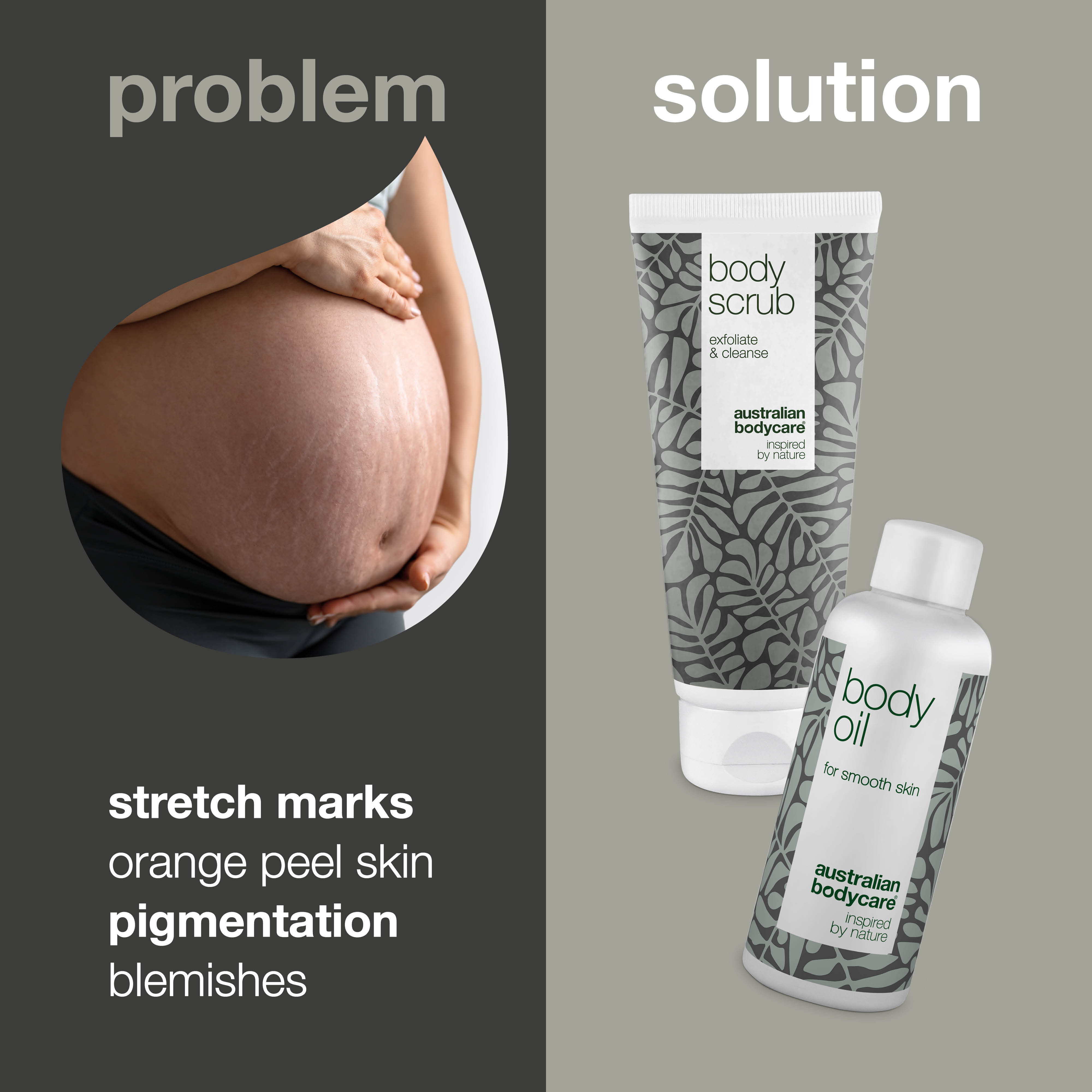 Pregnancy package for the pregnant woman with 2 products — Reduces the visibility of stretch marks and is used for the care of orange peel skin