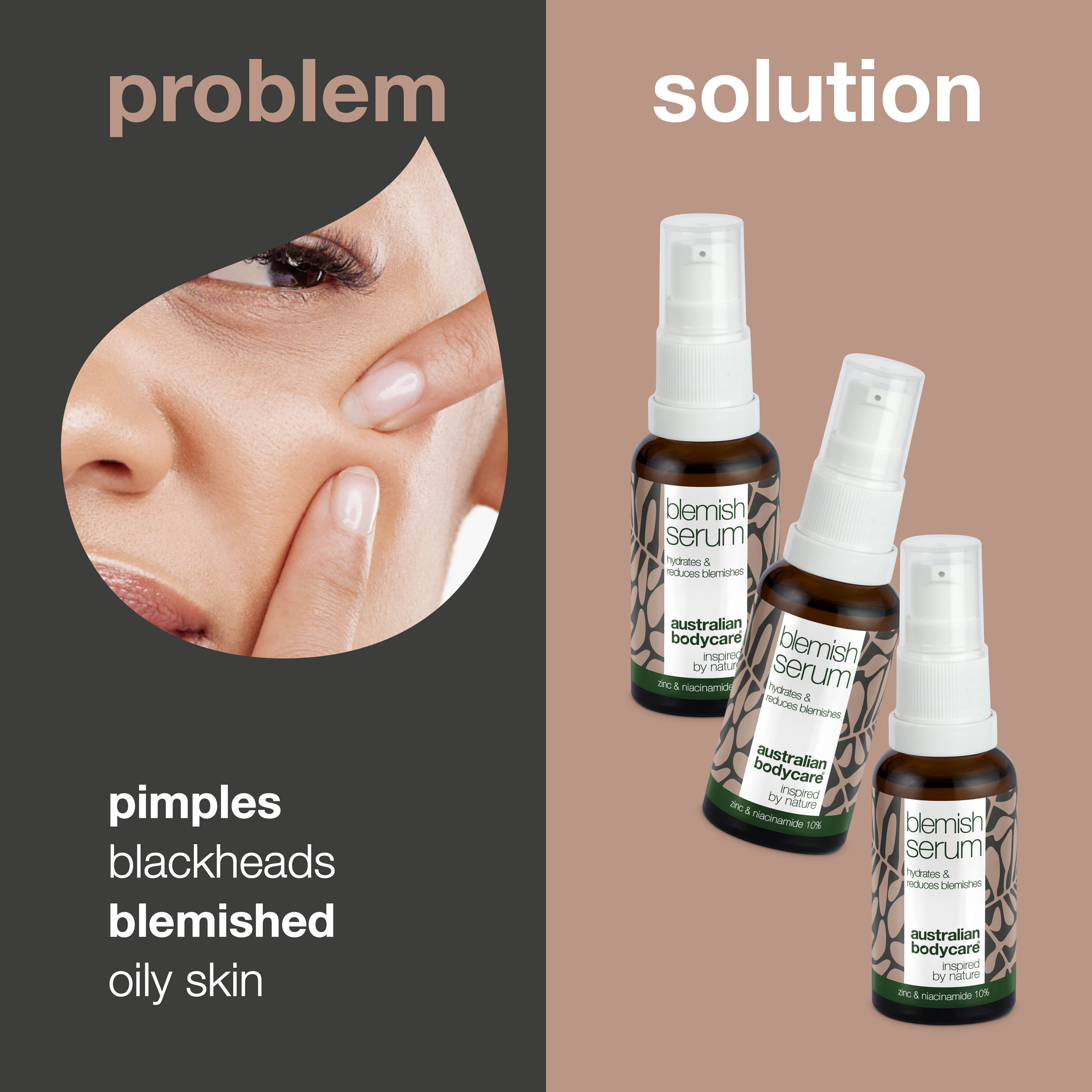 3x Niacinamide serums for pimples and blackheads