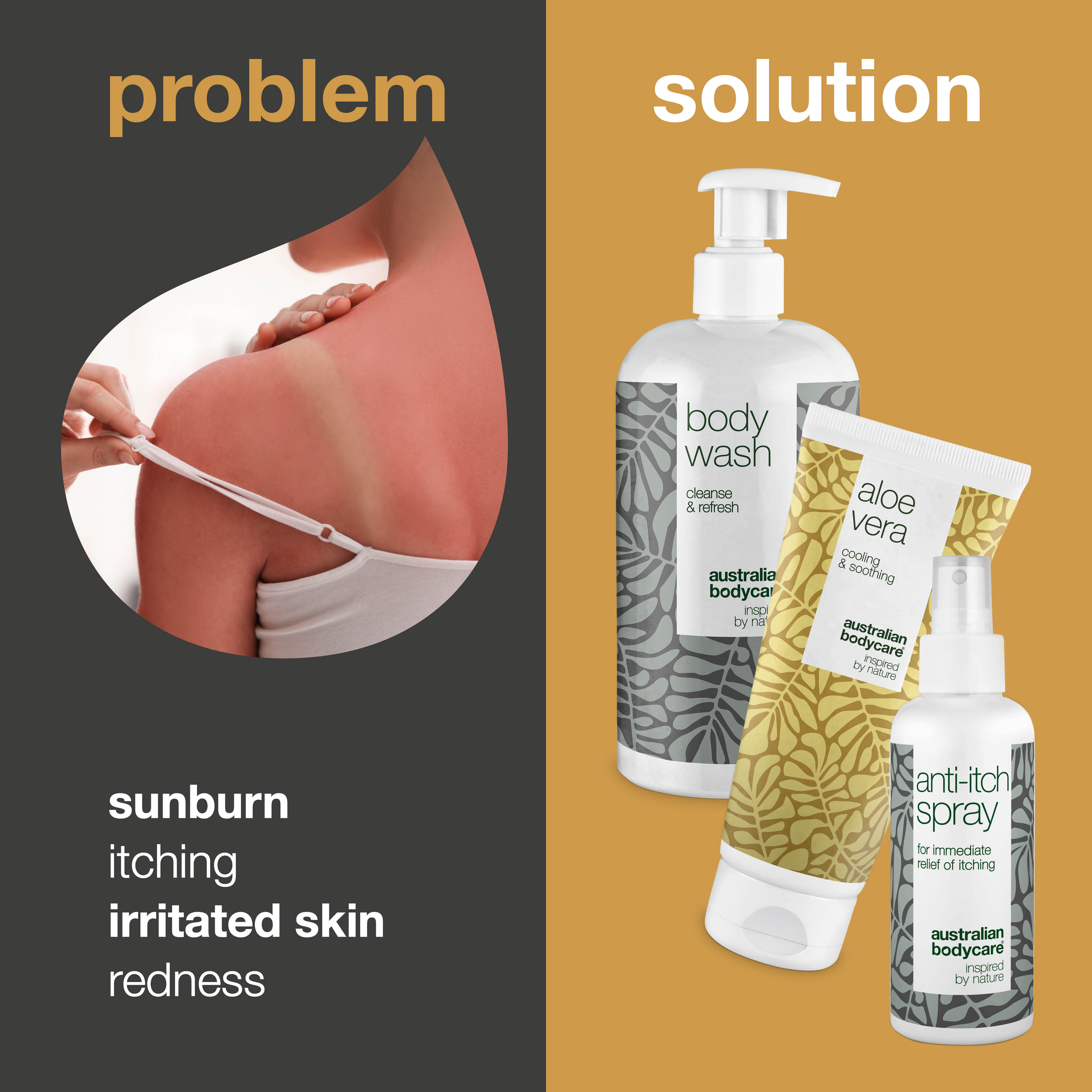 Aftersun set for red and sun damaged skin — 3 products to care for sunburn, burning sensation and sun rash