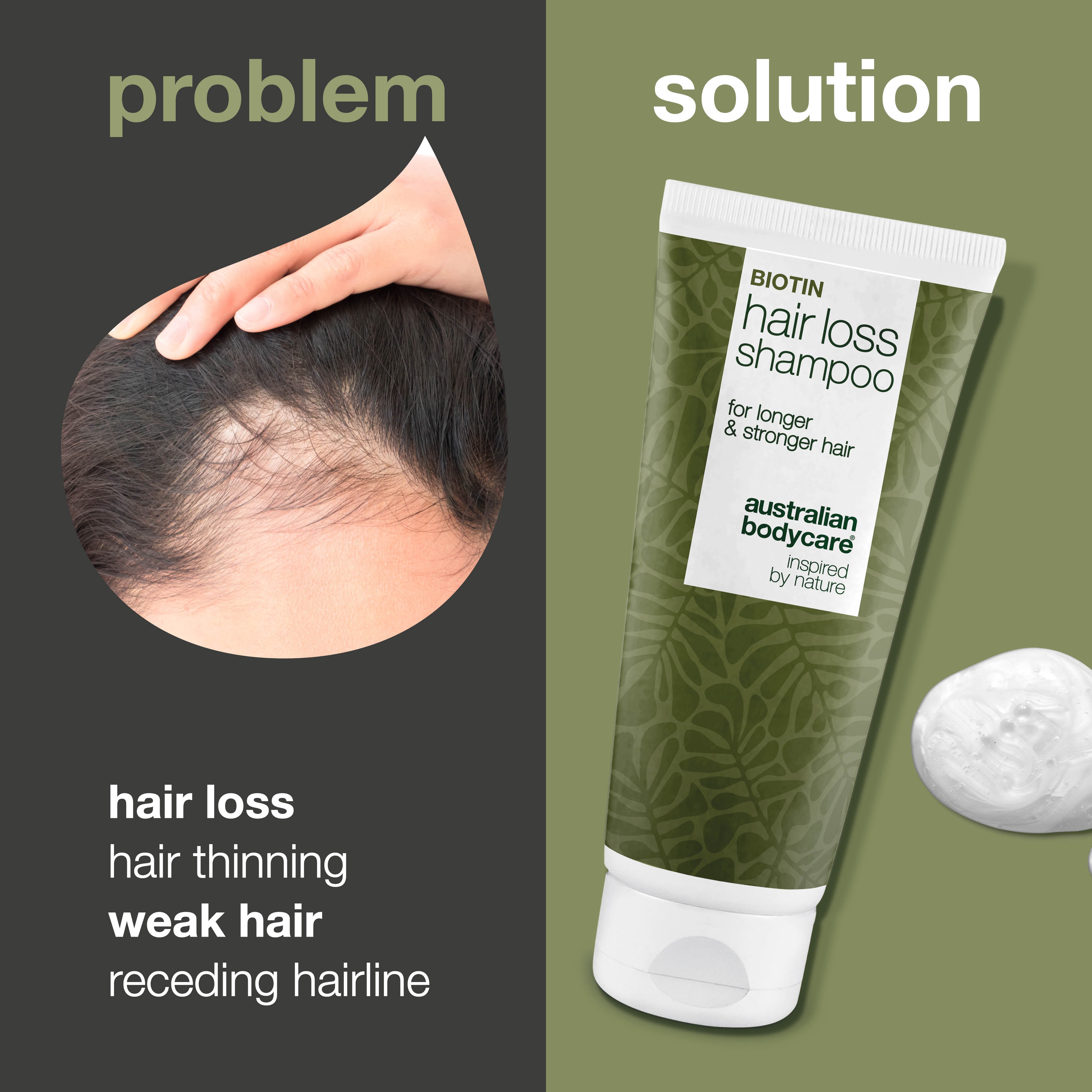 Shampoo reduces hair loss and thinning hair — Shampoo reduces hair loss and strengthens weak hair with biotin, caffeine, and Capilia Longa, which revitalize the scalp and stimulate hair roots.