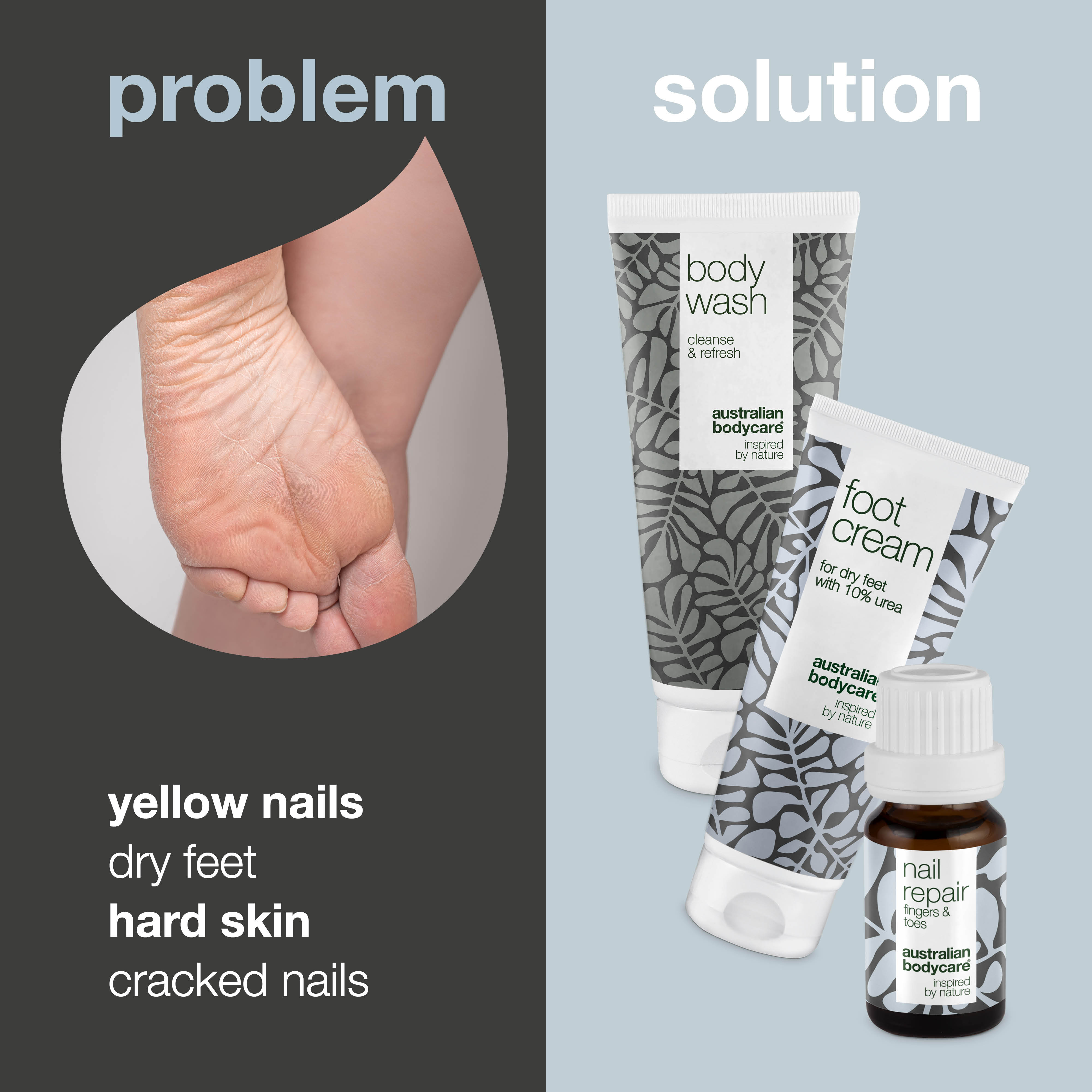 Footcare kit — 3 products for daily foot care of dry feet and yellow nails