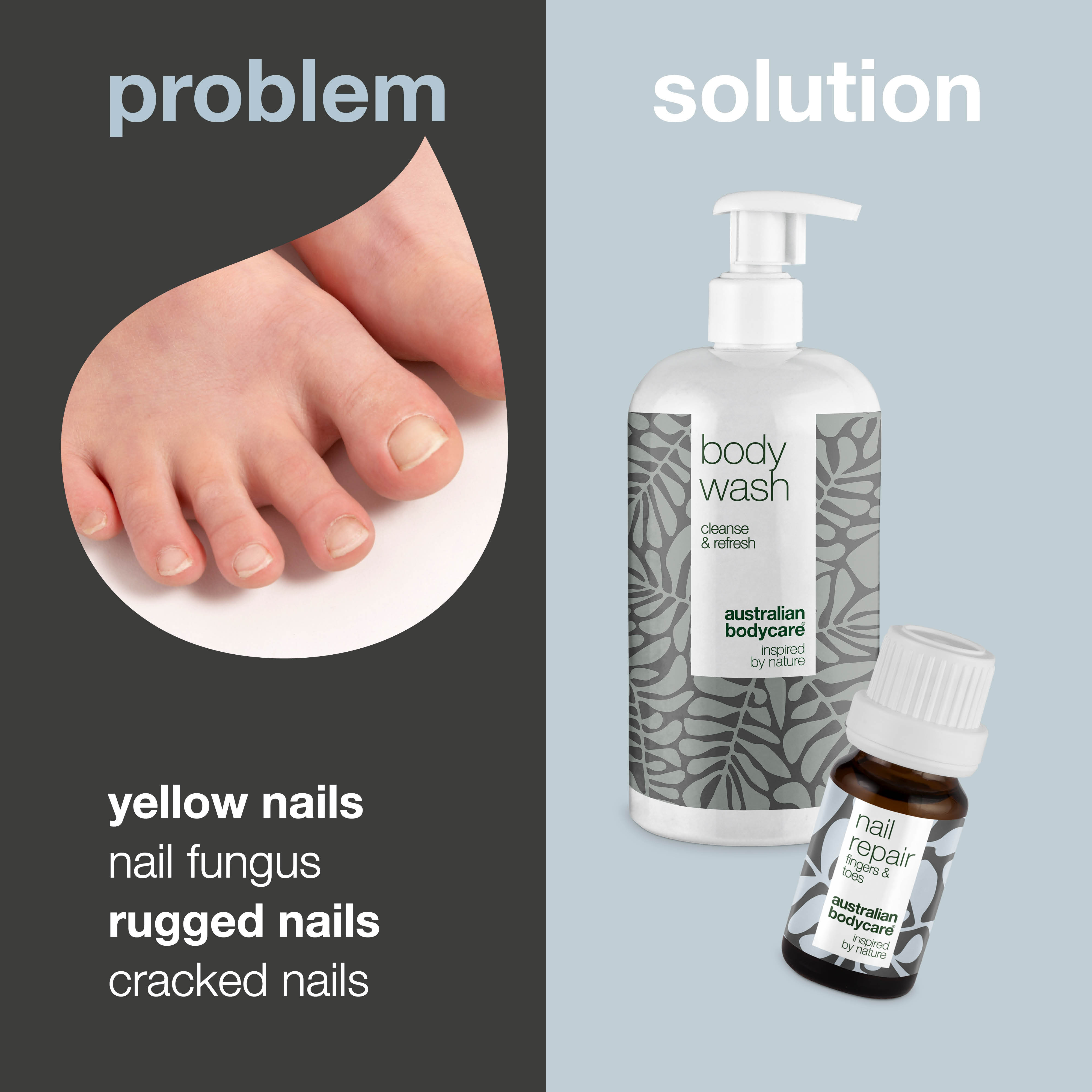 Nail care for yellow nails and nail fungus — 2 products for yellow nails and nail fungus