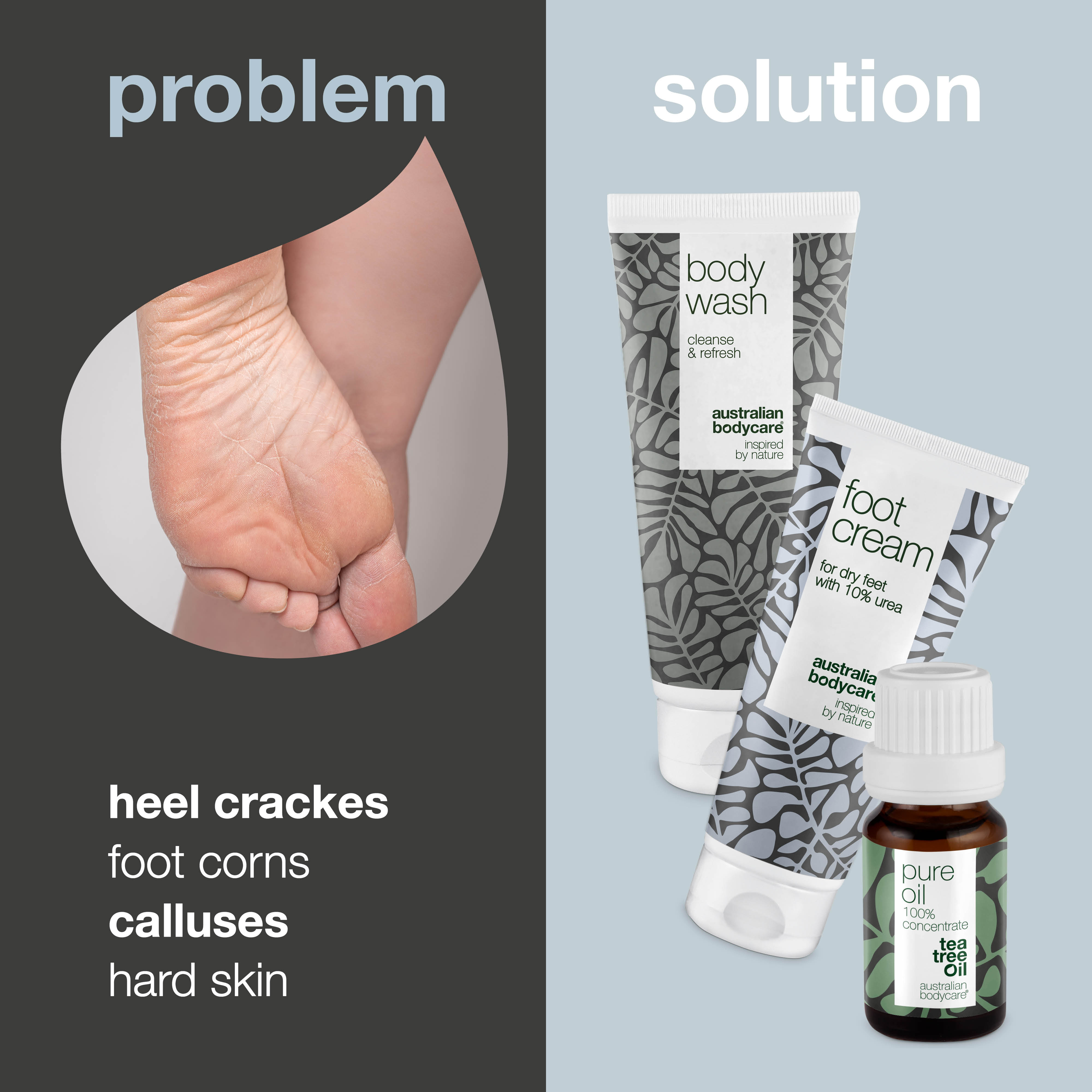 3 Products for hard skin and corn on feet and heels — Prevents and counteracts heel cracks, corns, calluses and hard skin on the feet