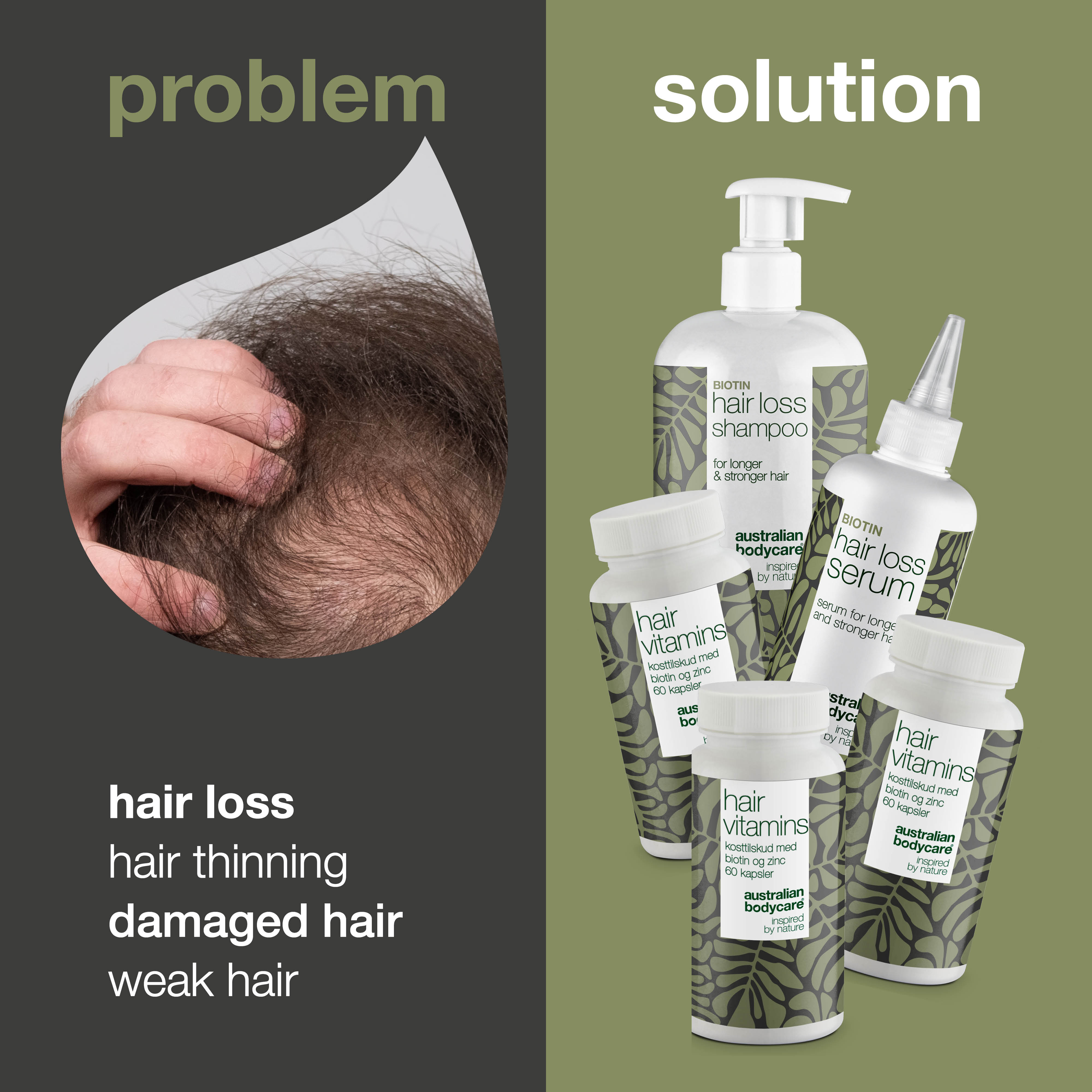 XL Hair Loss Pack — 5 Hair Loss Products with Biotin for Thinning Hair