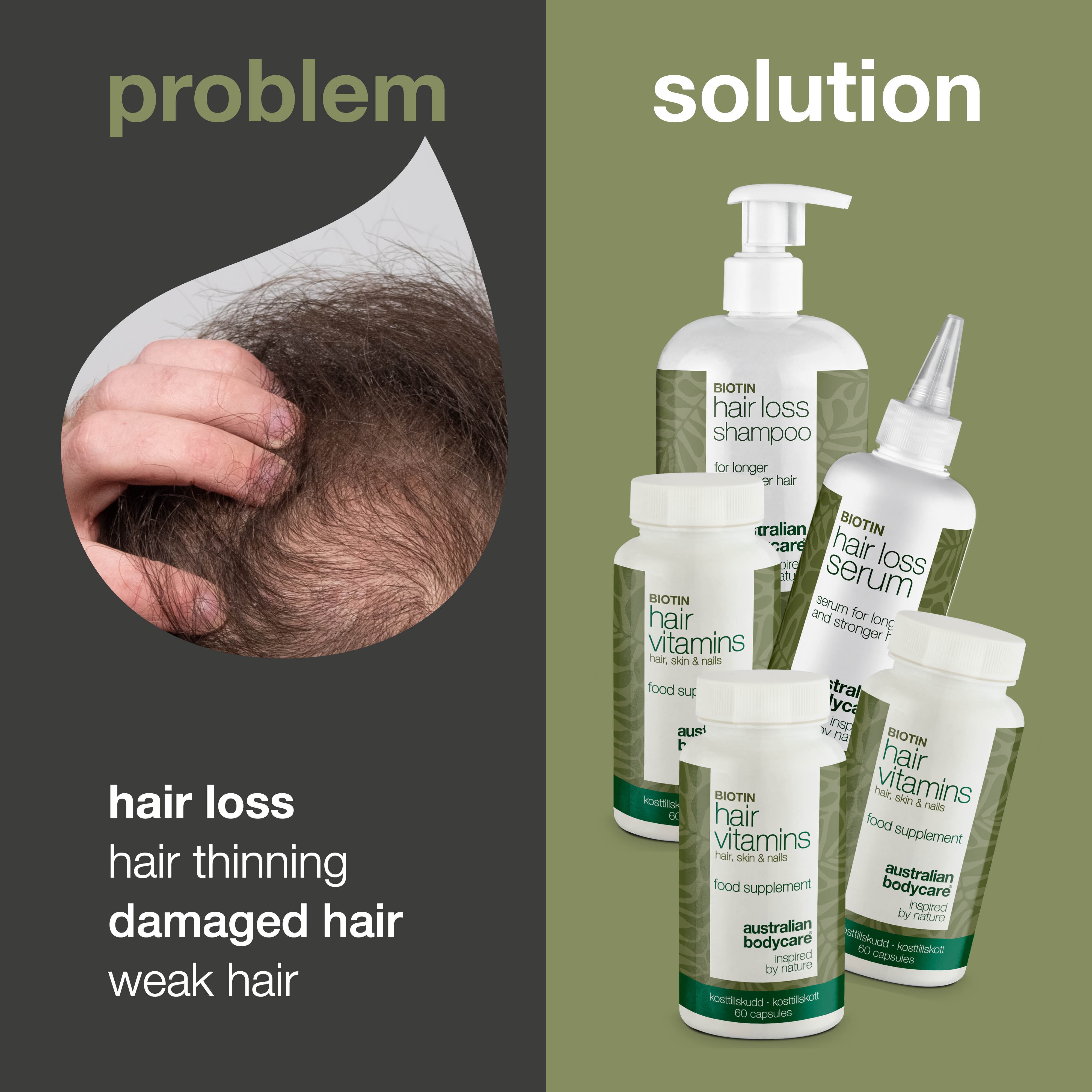 XL Hair Loss Pack — 5 Hair Loss Products with Biotin for Thinning Hair