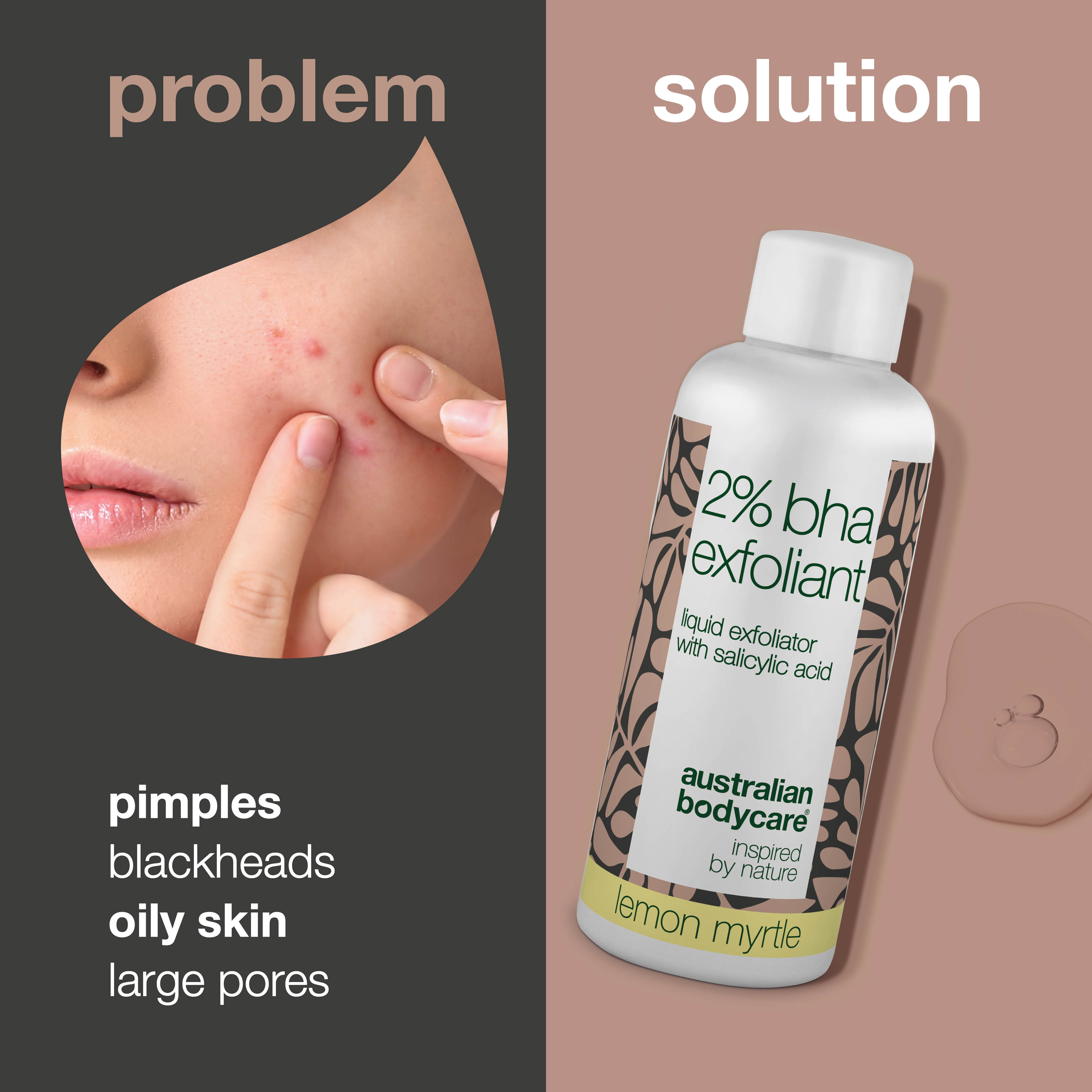 T-zone Peeling with 2% BHA Salicylic Acid – Fights blackheads