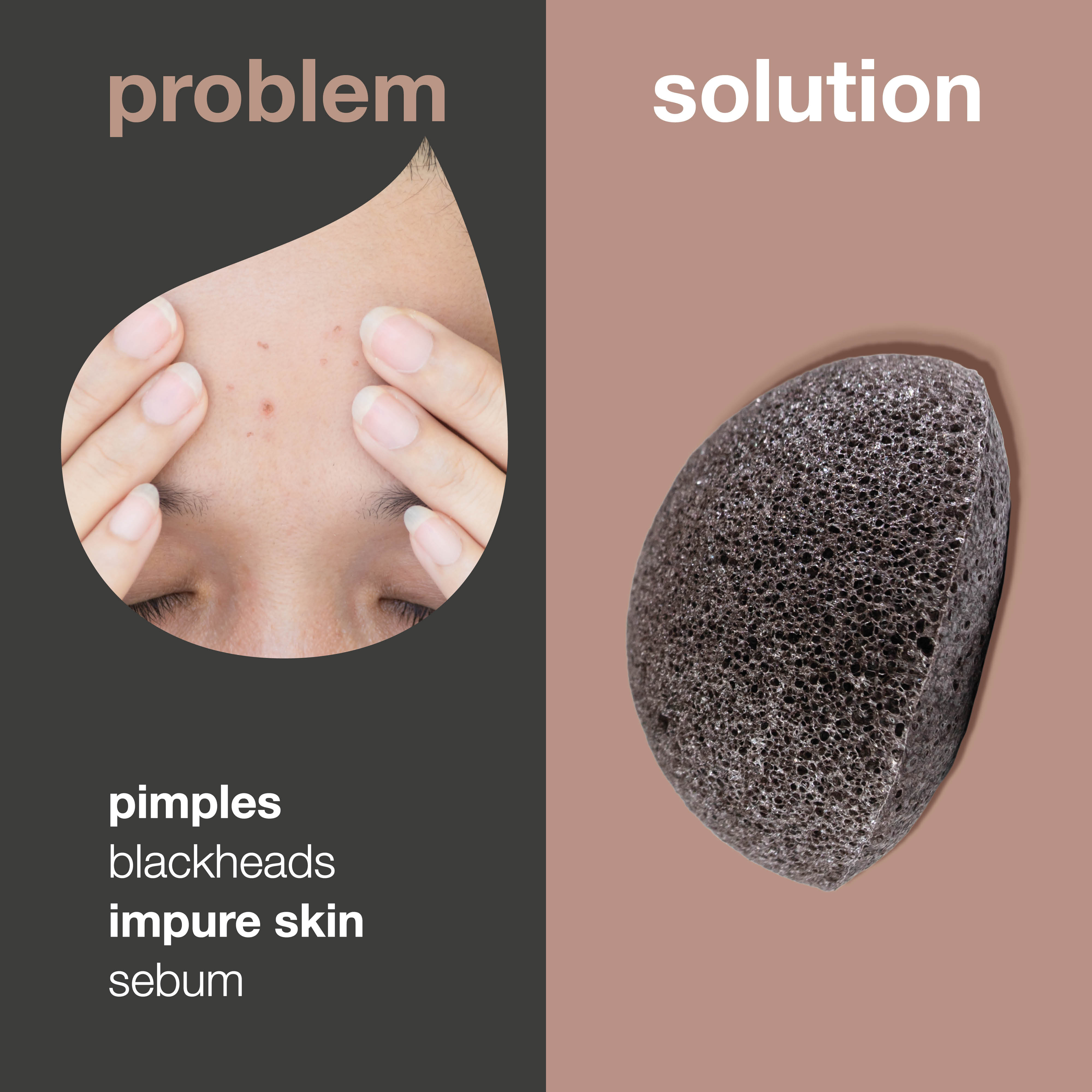 Konjac sponge for skin blemishes — Konjac Sponge for natural exfoliation of pimples and blackheads