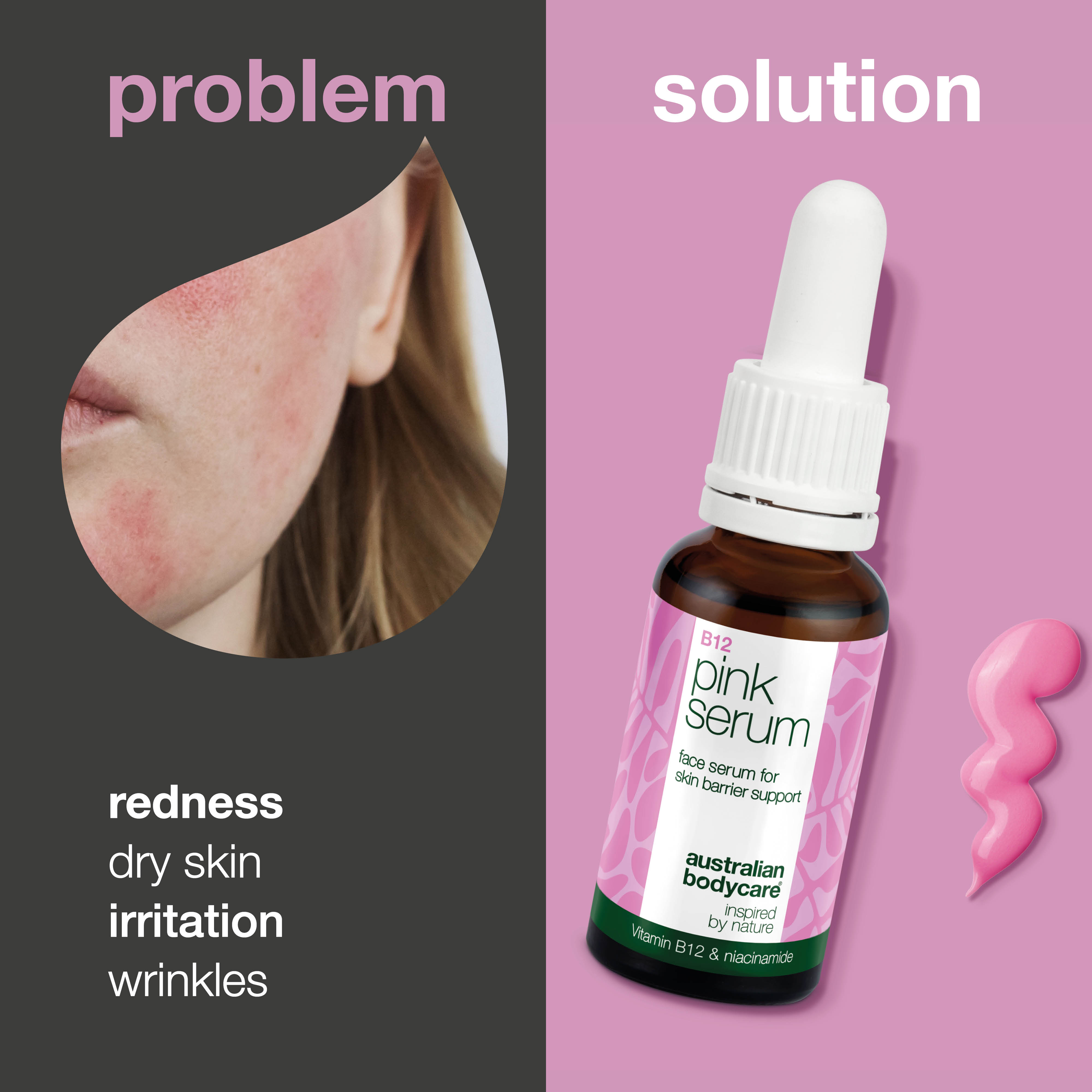 Vitamin B12 Pink Serum – Reduces redness and boosts glow — B12 Pink Serum strengthens the skin barrier, reduces redness and aging signs. Leaves skin soft and radiant.