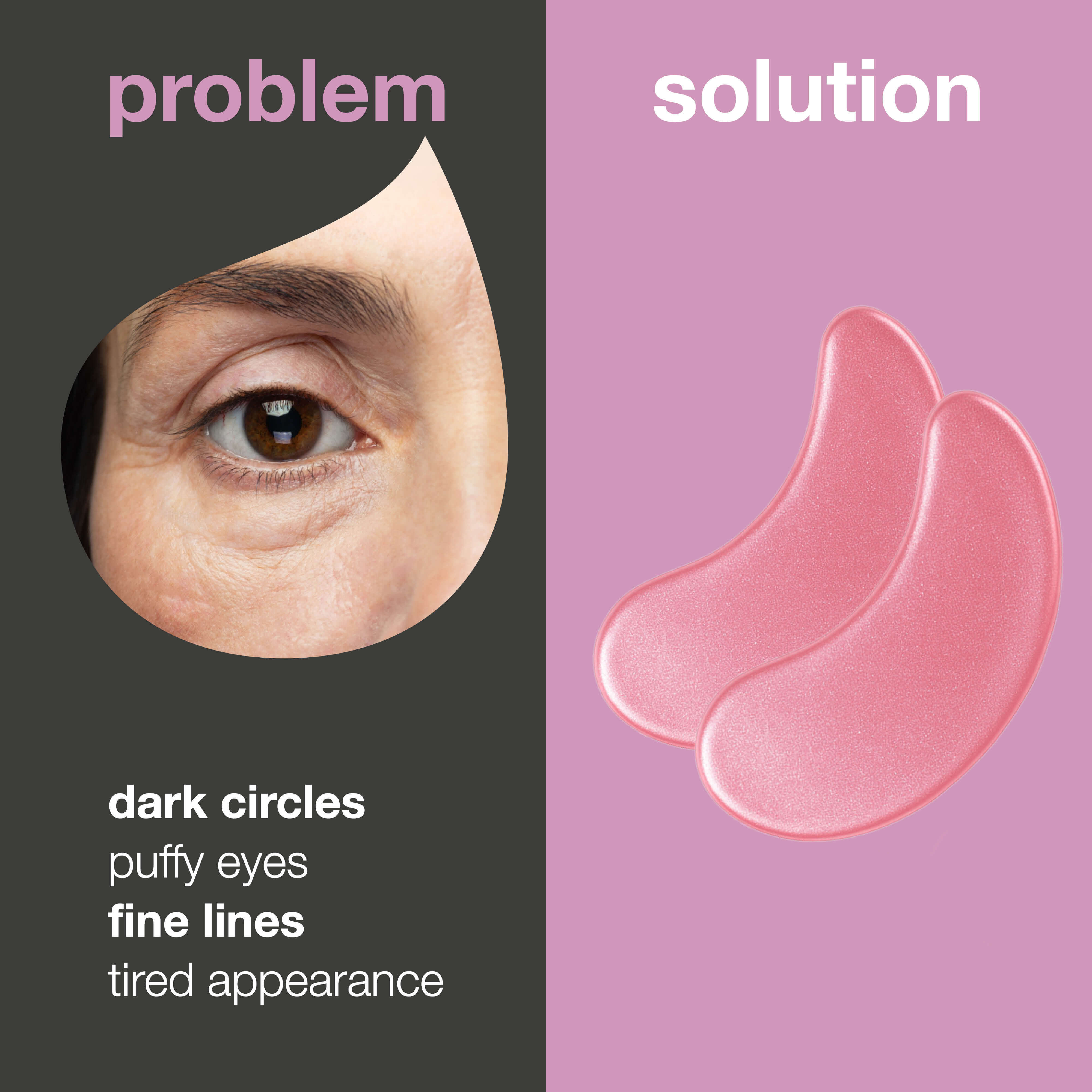 B12 Vitamin Eye Masks for Dark Circles & Puffiness — Reduce dark circles and puffiness with B12 eye masks. Hydrates and refreshes the skin in just 20 minutes. Perfect for tired eyes!