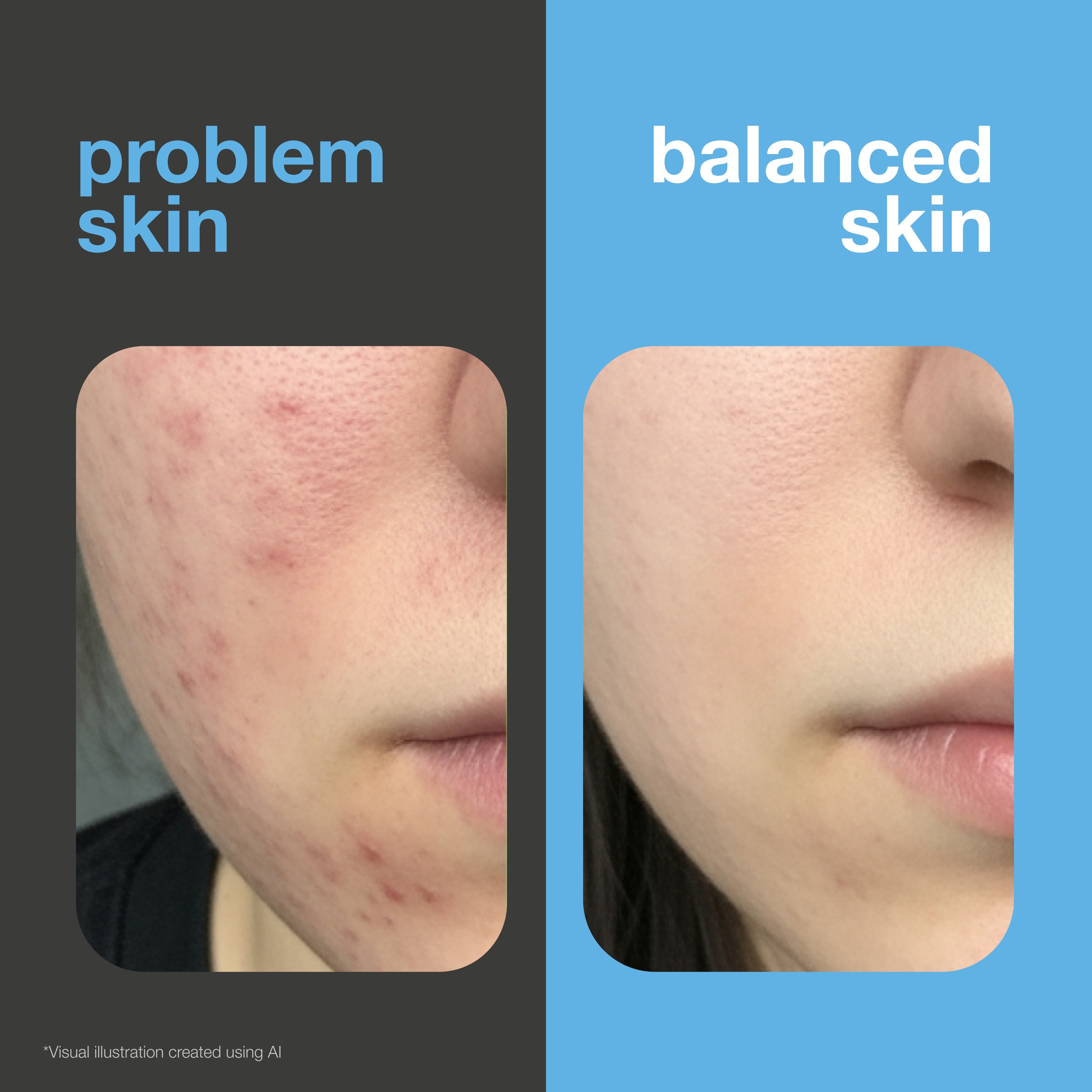 Before and after: face with spots and redness versus clearer, more balanced skin. Visual illustration.