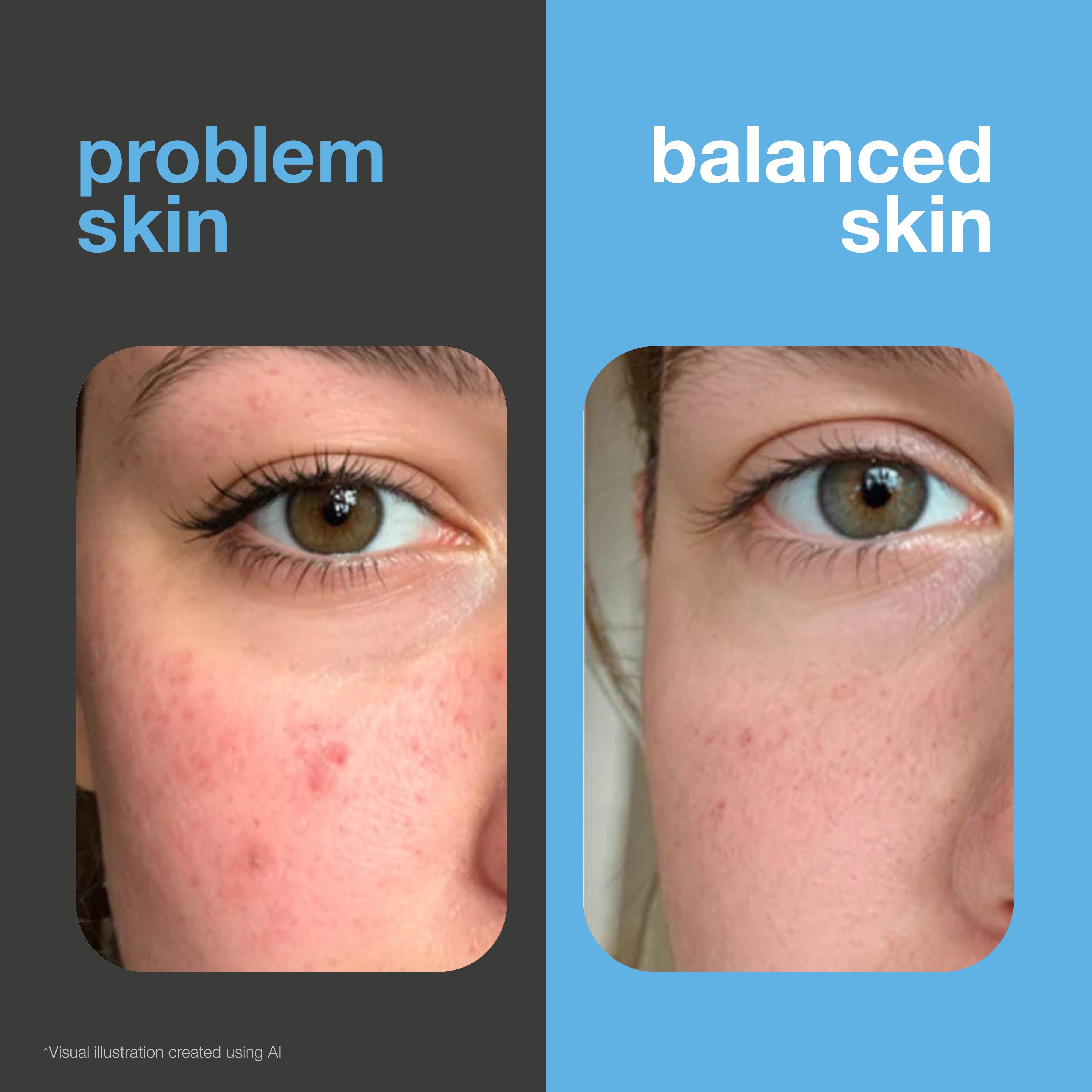 Before and after: face with spots and redness versus clearer, more balanced skin. Visual illustration.