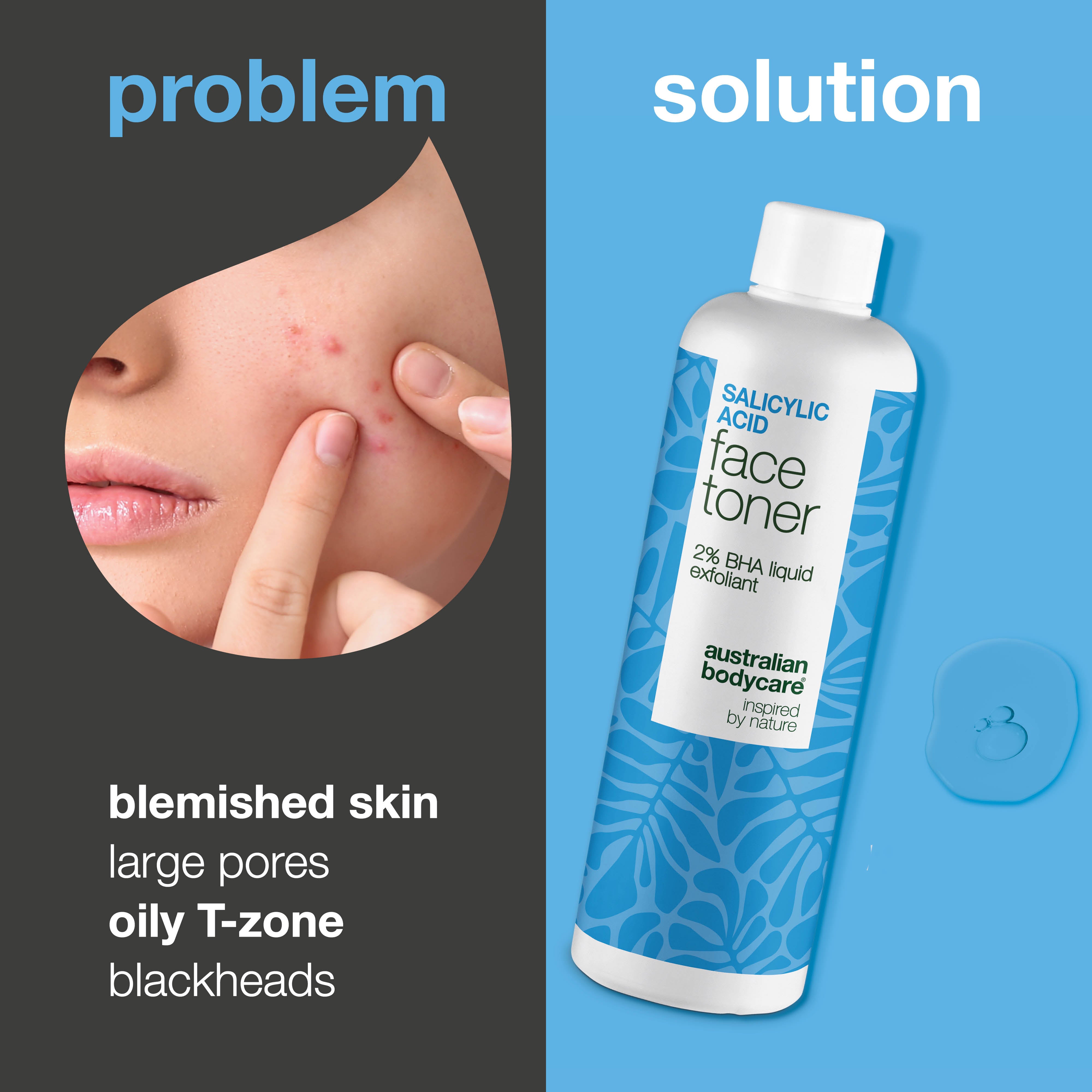 Salicylic Acid toner targets blemishes, large pores and uneven texture. Ideal for acne-prone skin. Contains Salicylic Acid from Australian Bodycare.