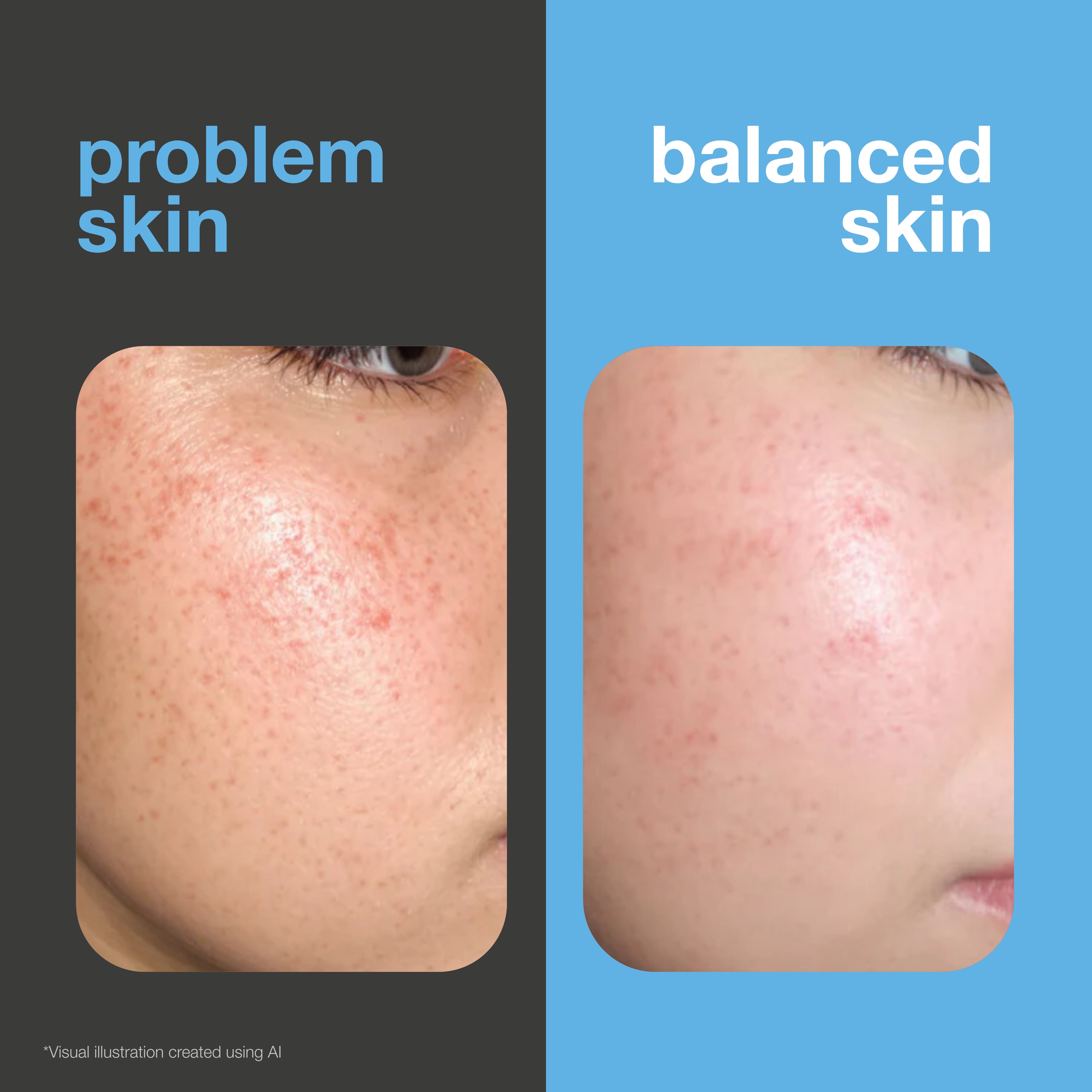 Before and after: face with spots and redness versus clearer, more balanced skin. Visual illustration.