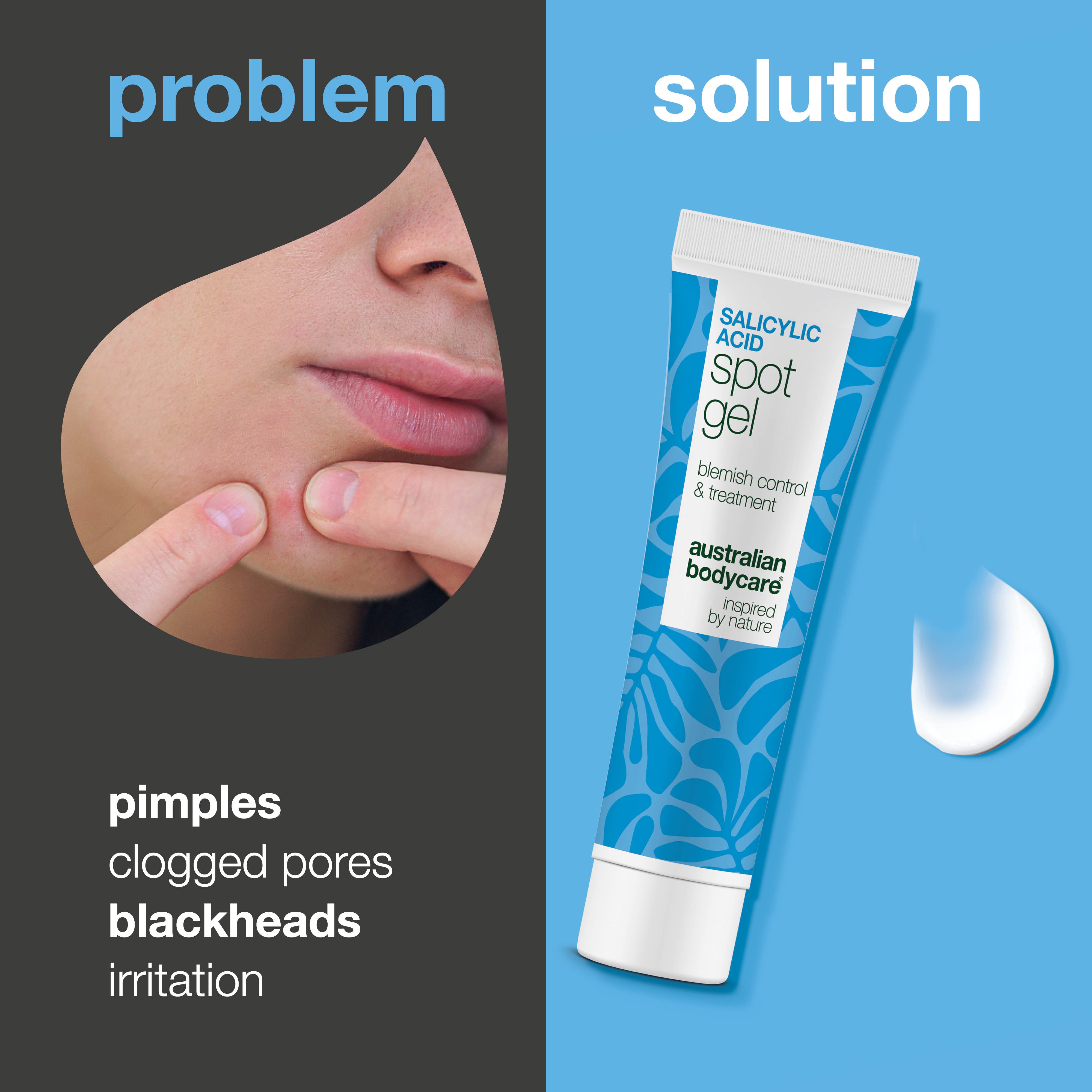 Salicylic Acid Spot Gel for breakouts, blackheads and redness – unclogs pores and calms the skin