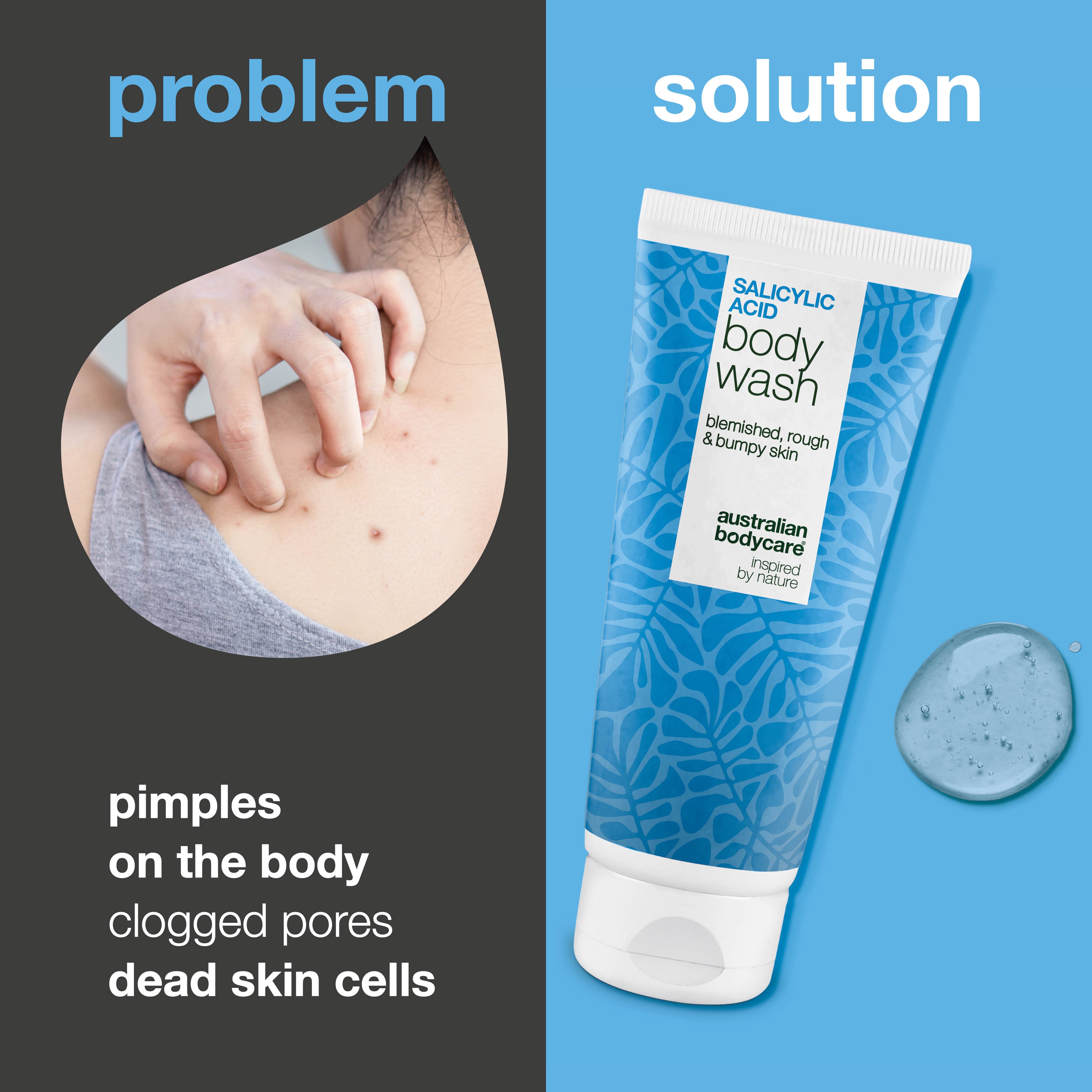 Salicylic Acid Body Wash helps reduce blemishes on back, chest and buttocks. Gently exfoliates with salicylic acid, niacinamide and skin-balancing zinc PCA.