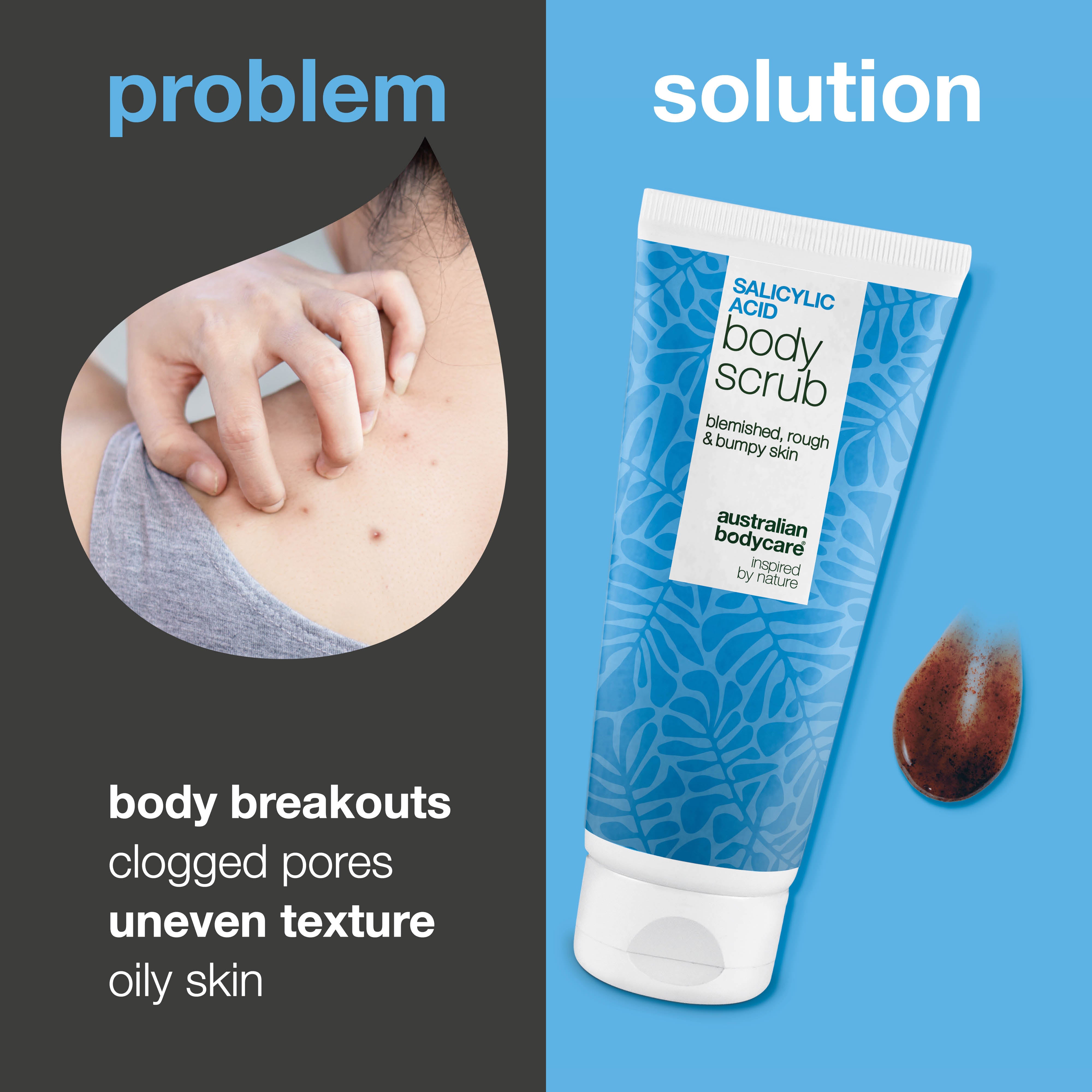 Body Scrub with Salicylic Acid for body breakouts and clogged pores — Body Scrub with Salicylic Acid removes dead skin and prevents bumps. With Salicylic Acid, Glycolic Acid, Glycerin, and Allantoin.