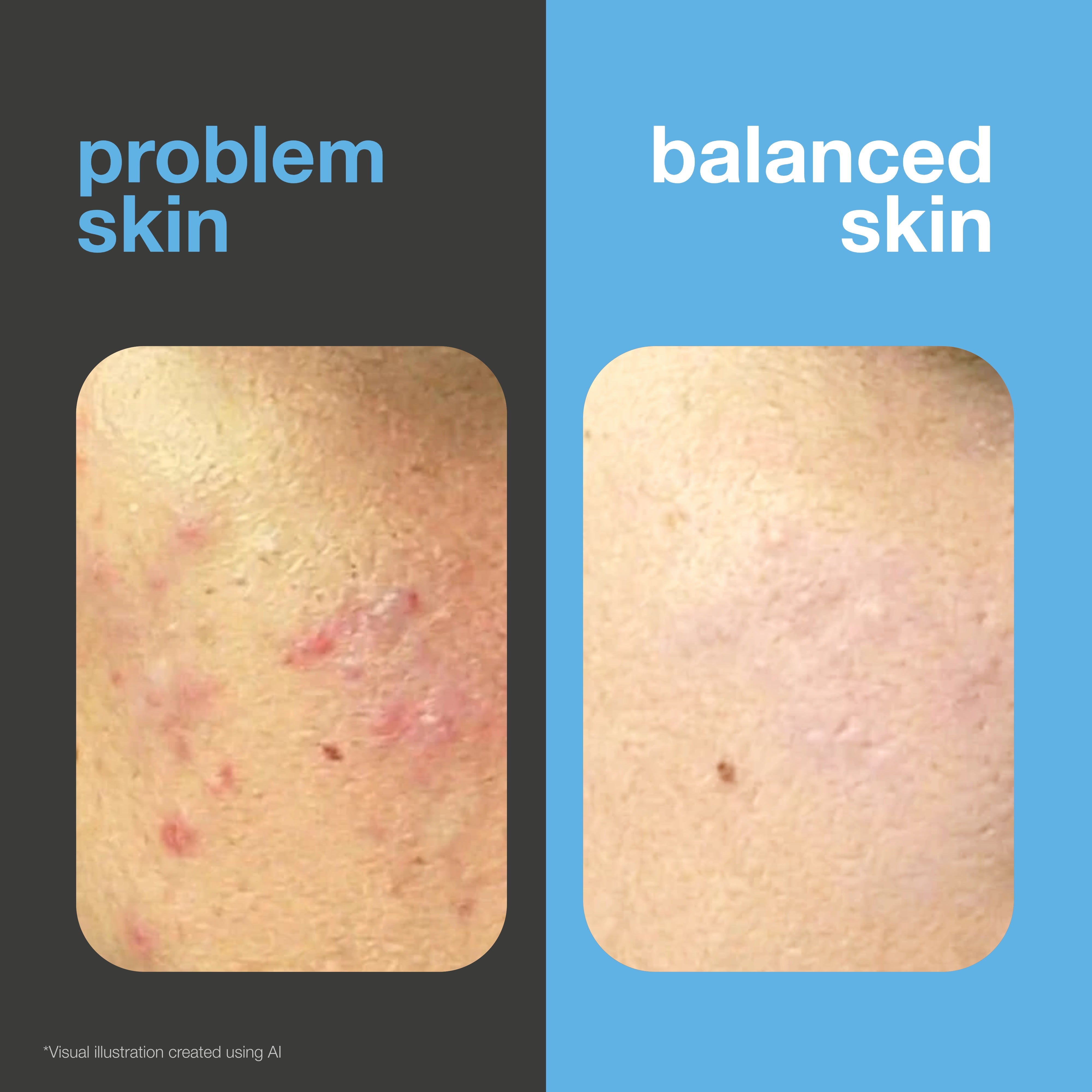 Before and after: face with spots and redness versus clearer, more balanced skin. Visual illustration.