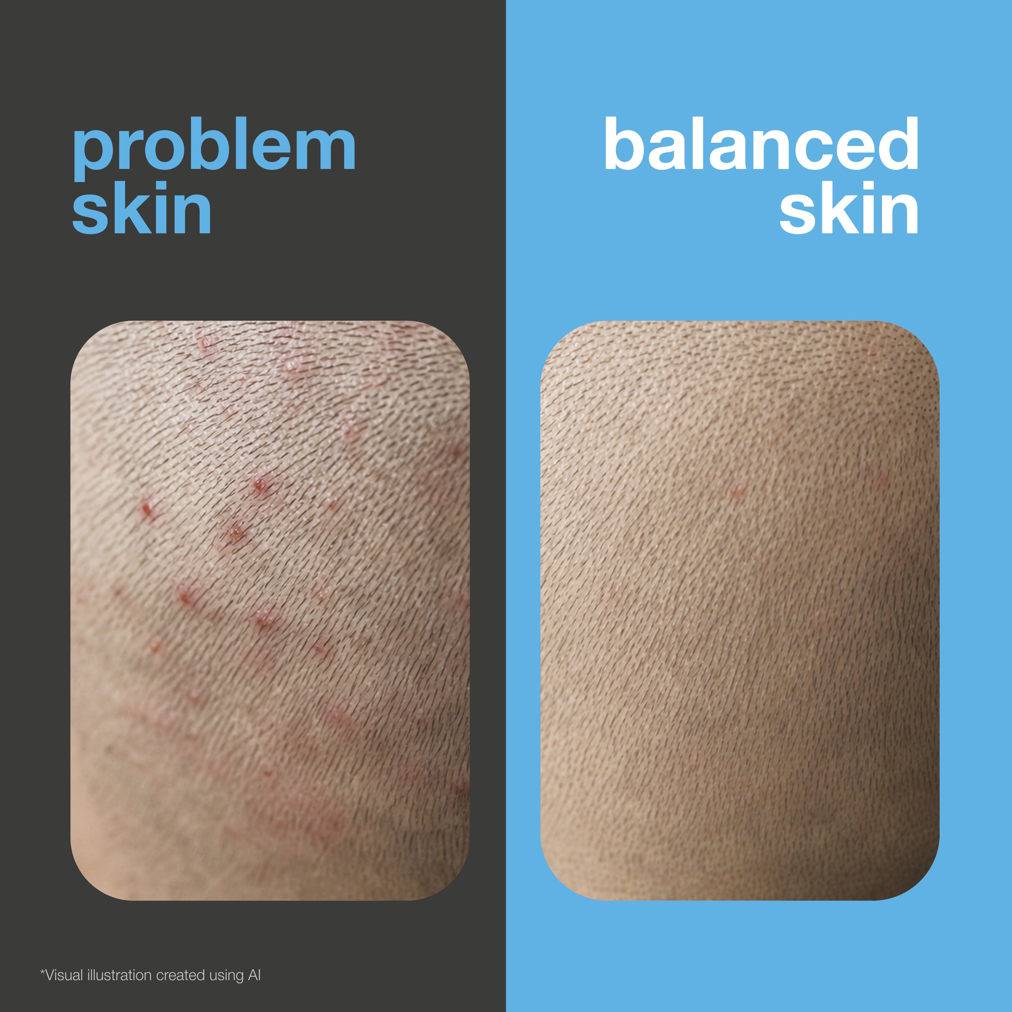 Before and after: scalp with red bumps and irritation versus a calm, balanced scalp. Visual illustration.
