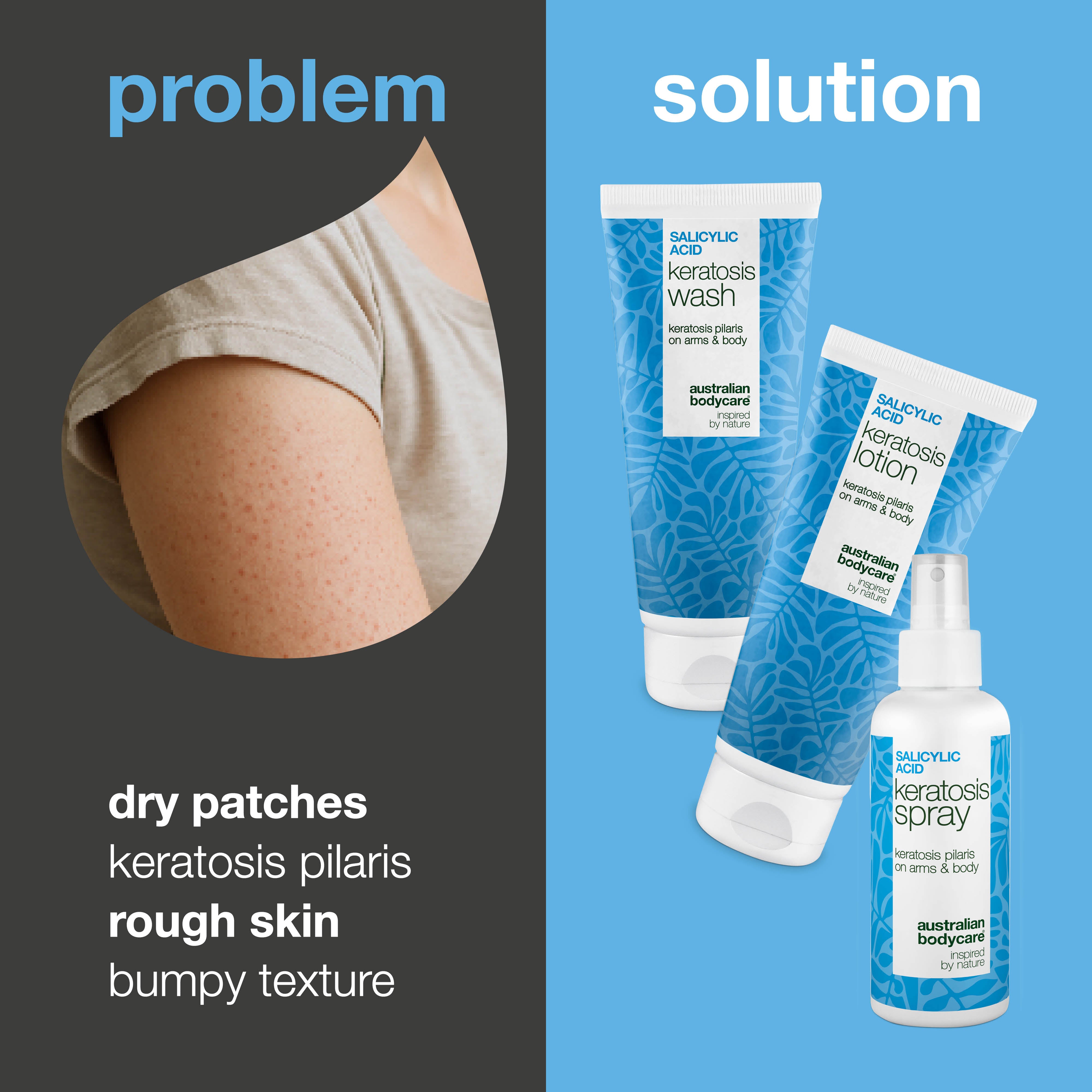 Keratosis Pilaris Kit Treatment – Smooth Rough and Bumpy Skin — Softens Rough, Bumpy and Dry Skin. Smooths Chicken Skin & Strawberry Skin on Arms, Thighs (Strawberry Legs) and Buttocks