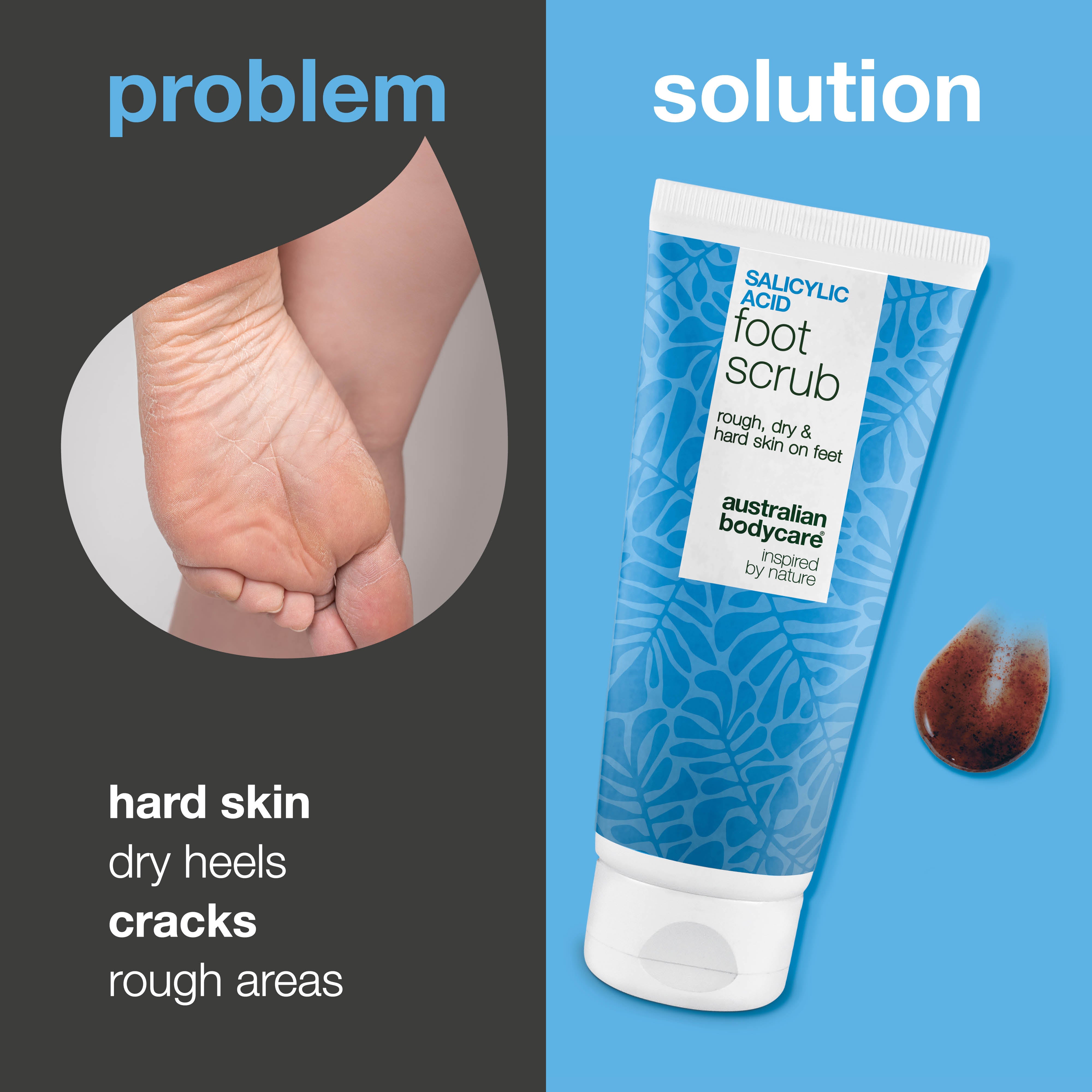 Exfoliating foot scrub with salicylic acid for dry and rough skin